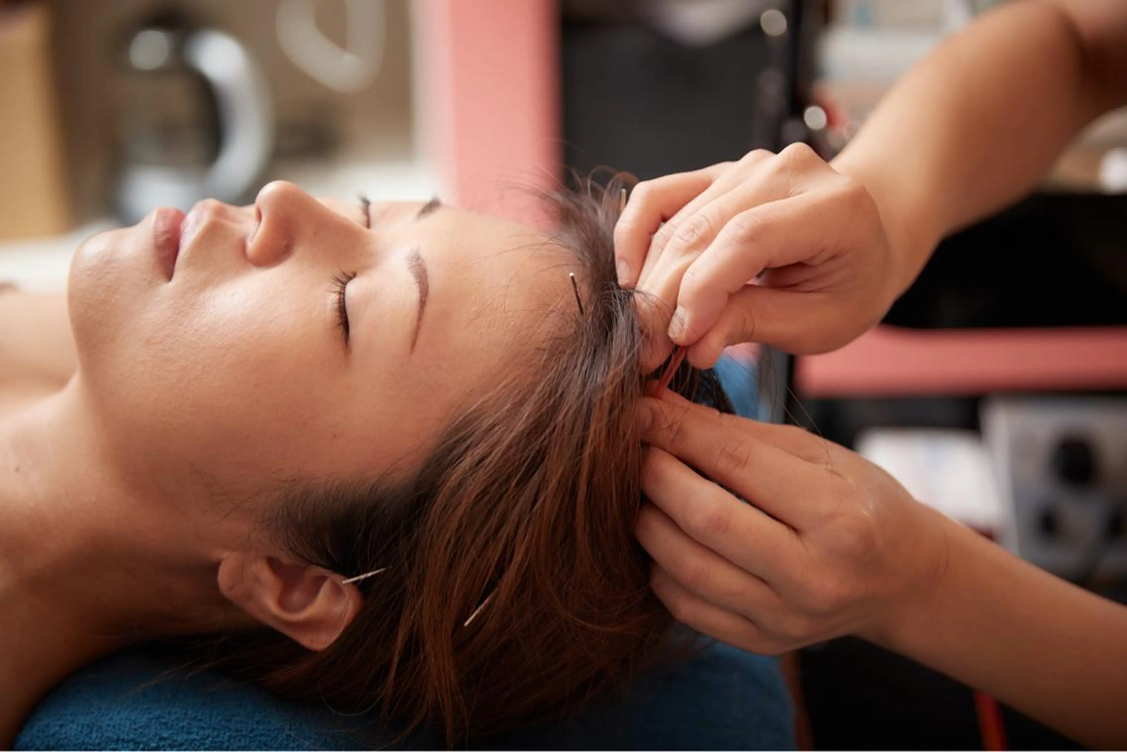 美楽鍼 びらくしんのその他イメージ