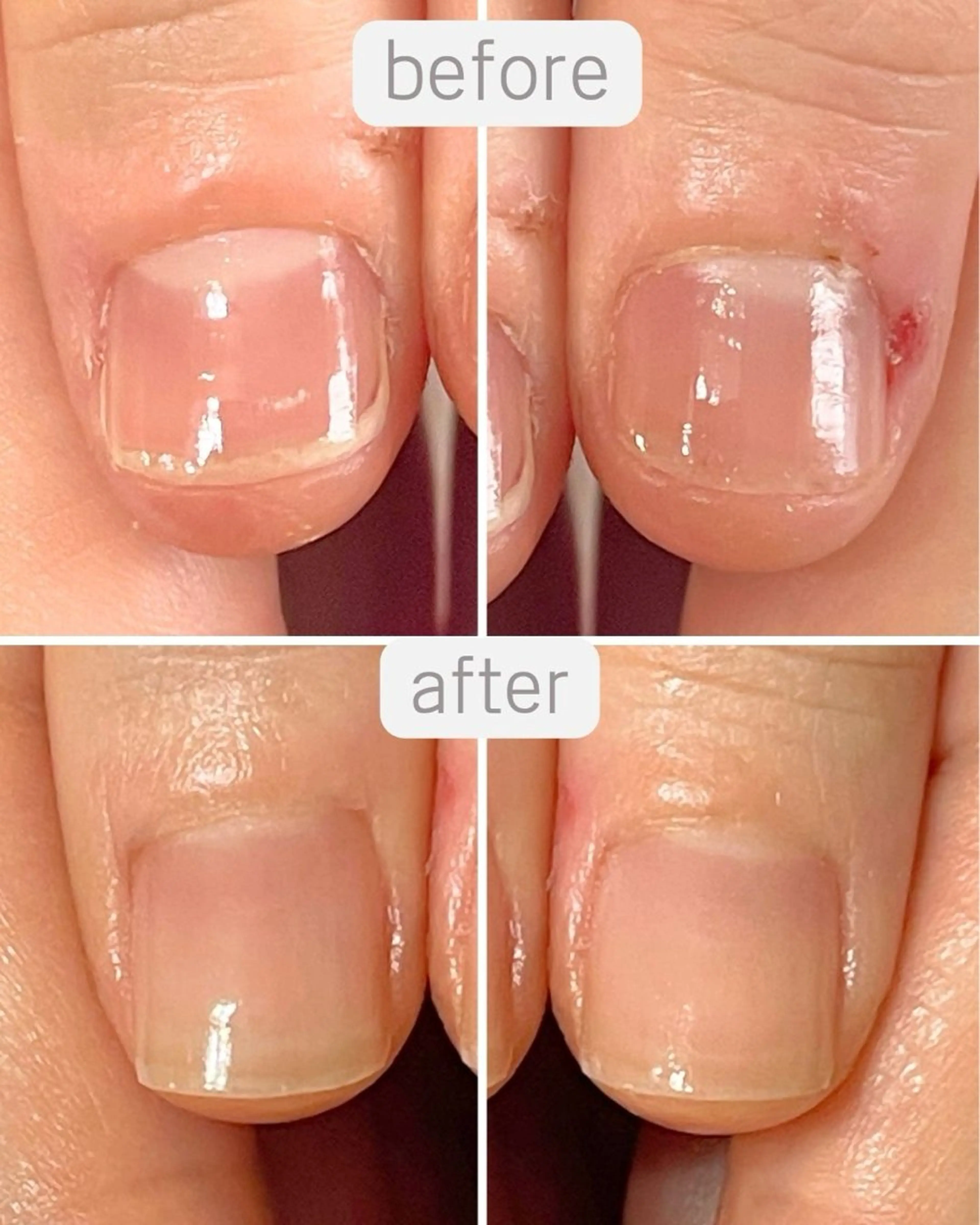 ネイル ハンドネイル ハンドケア 自爪育成専門店 Kapilinaのネイルデザイン