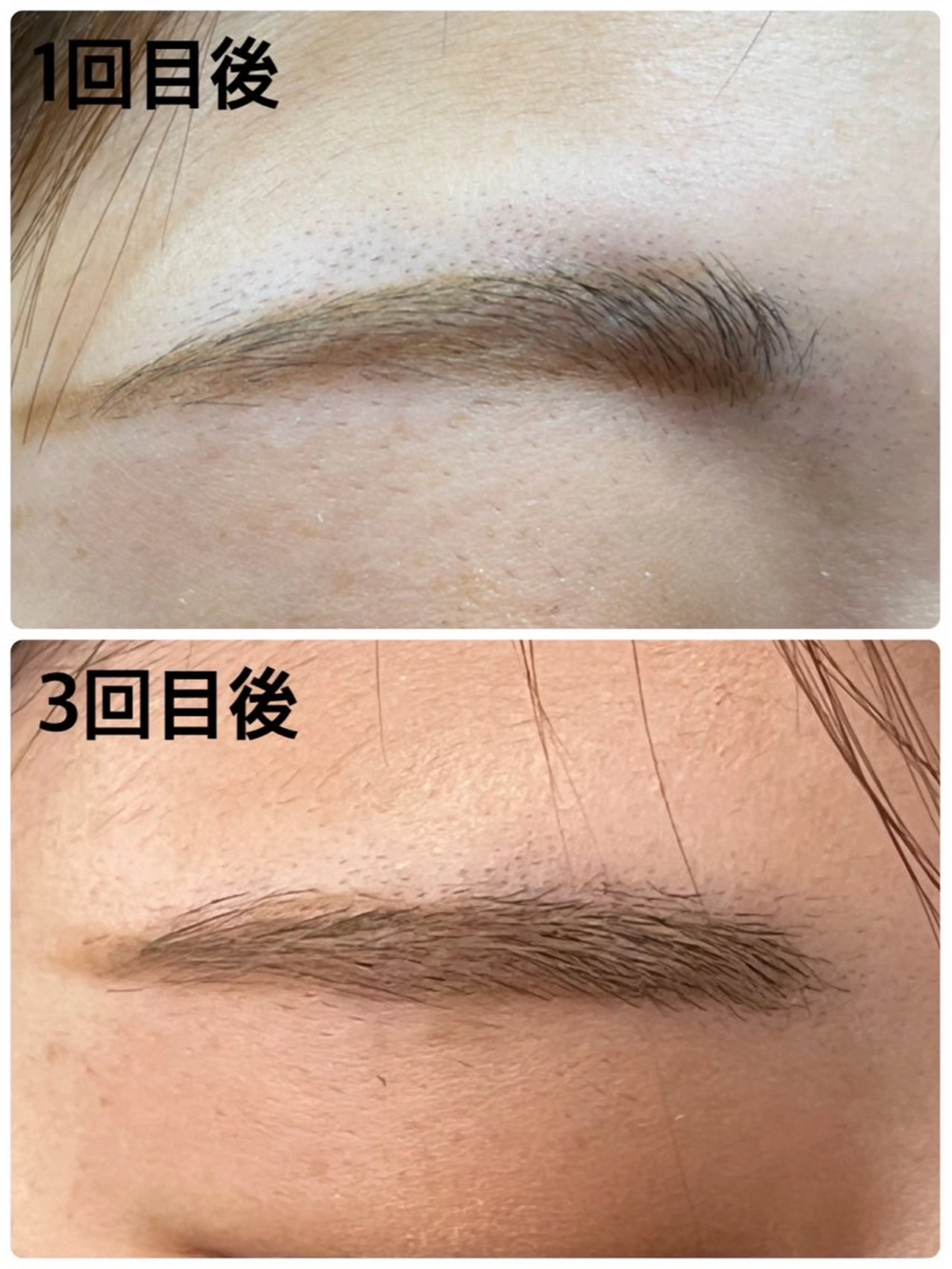 アイブロウ 眉毛ワックス脱毛 その他(アイブロウ) みんなの脱毛 TSURURINのエステ・リラクイメージ