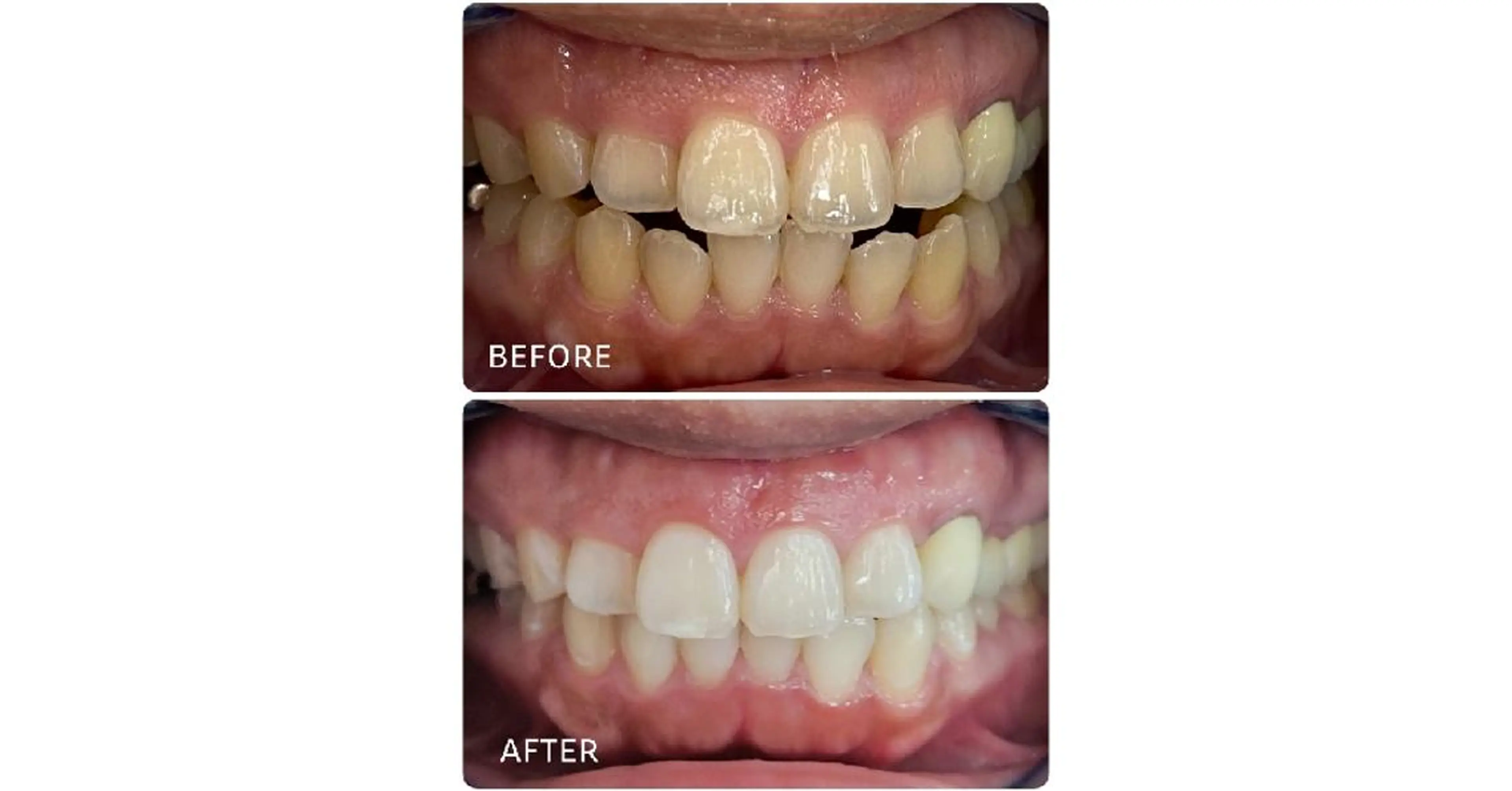 ホワイトニングサロン ラウレアのその他イメージ