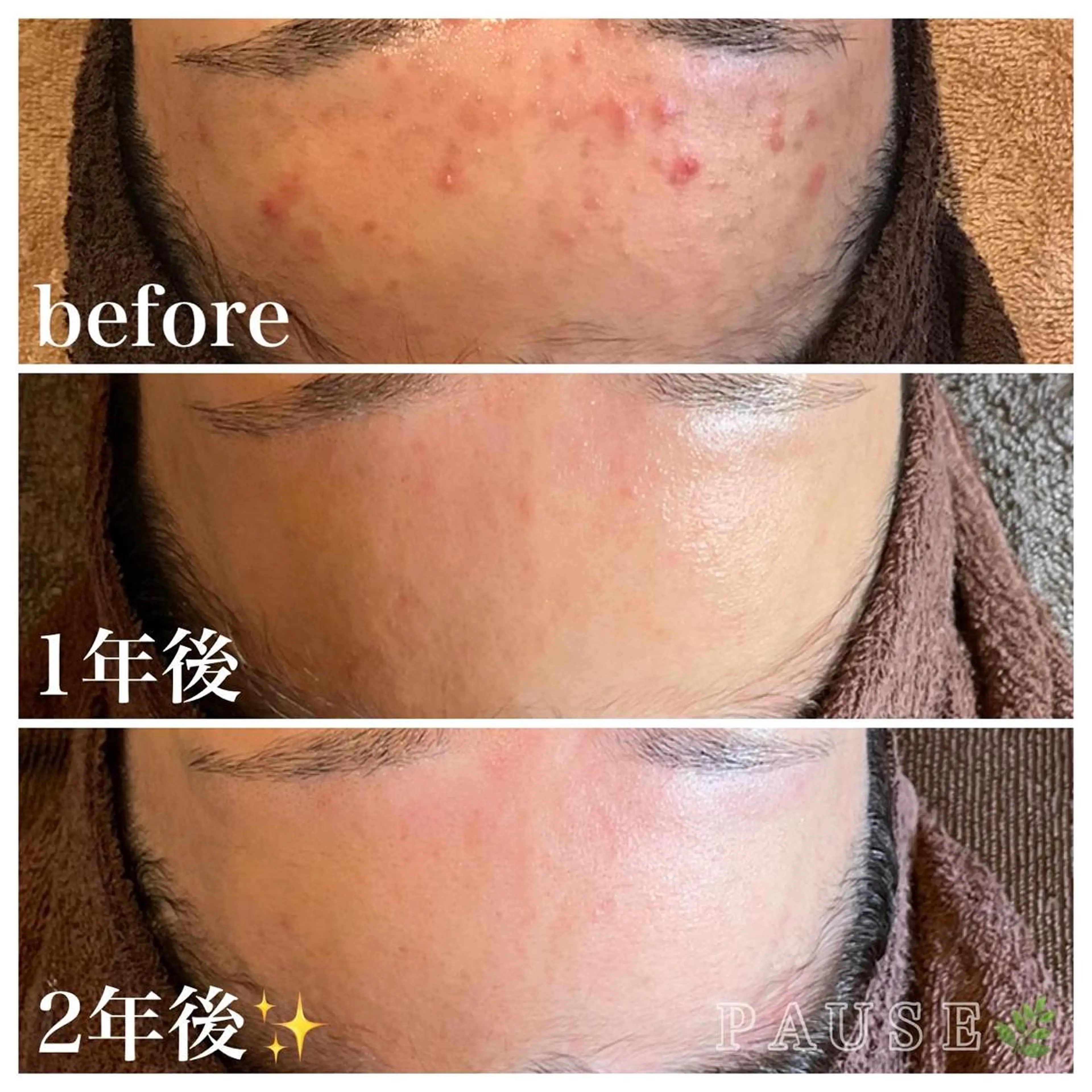 エステ 浜野 恵美のエステ・リラクイメージ