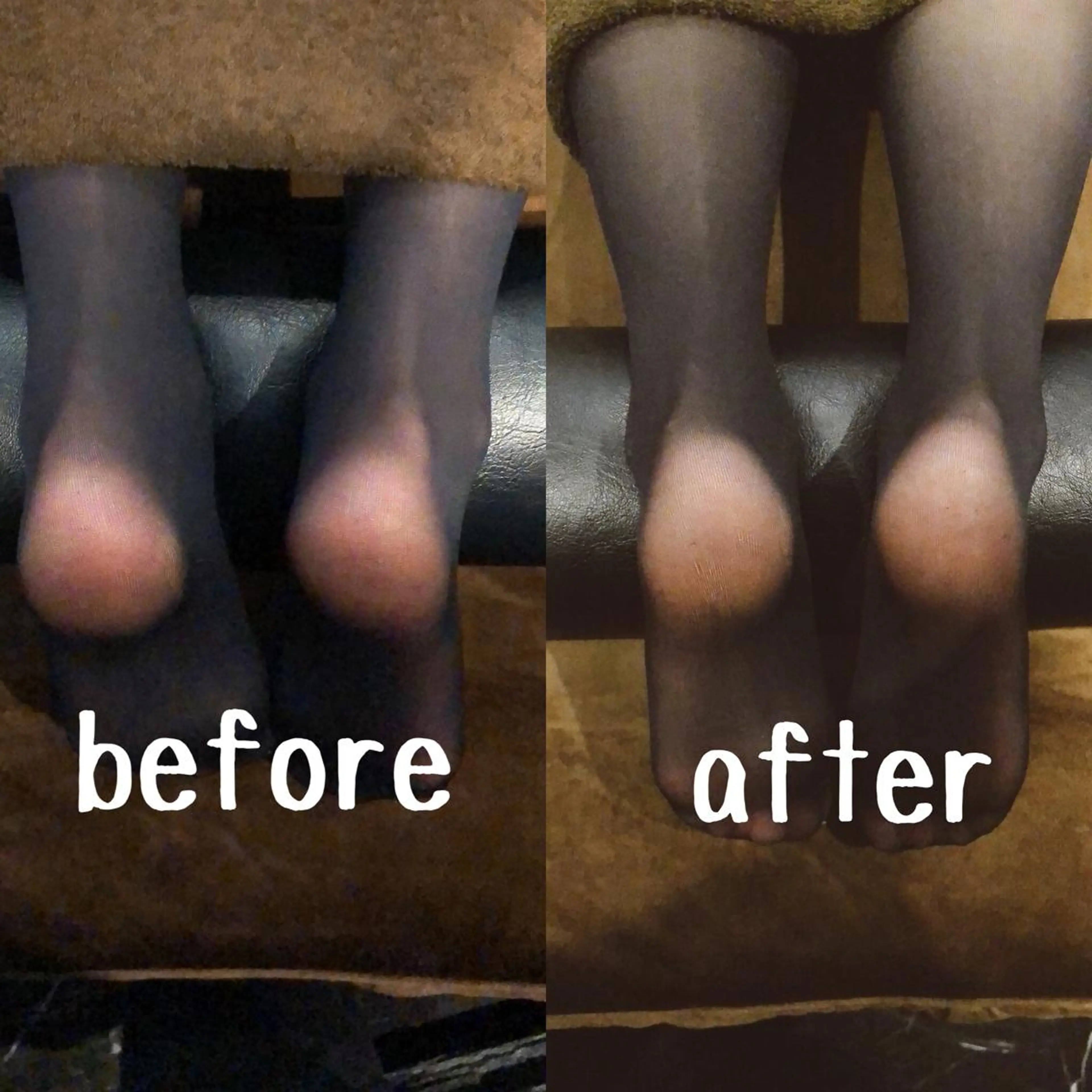 その他 小顔矯/美容鍼/鍼灸 BeauJuのその他イメージ