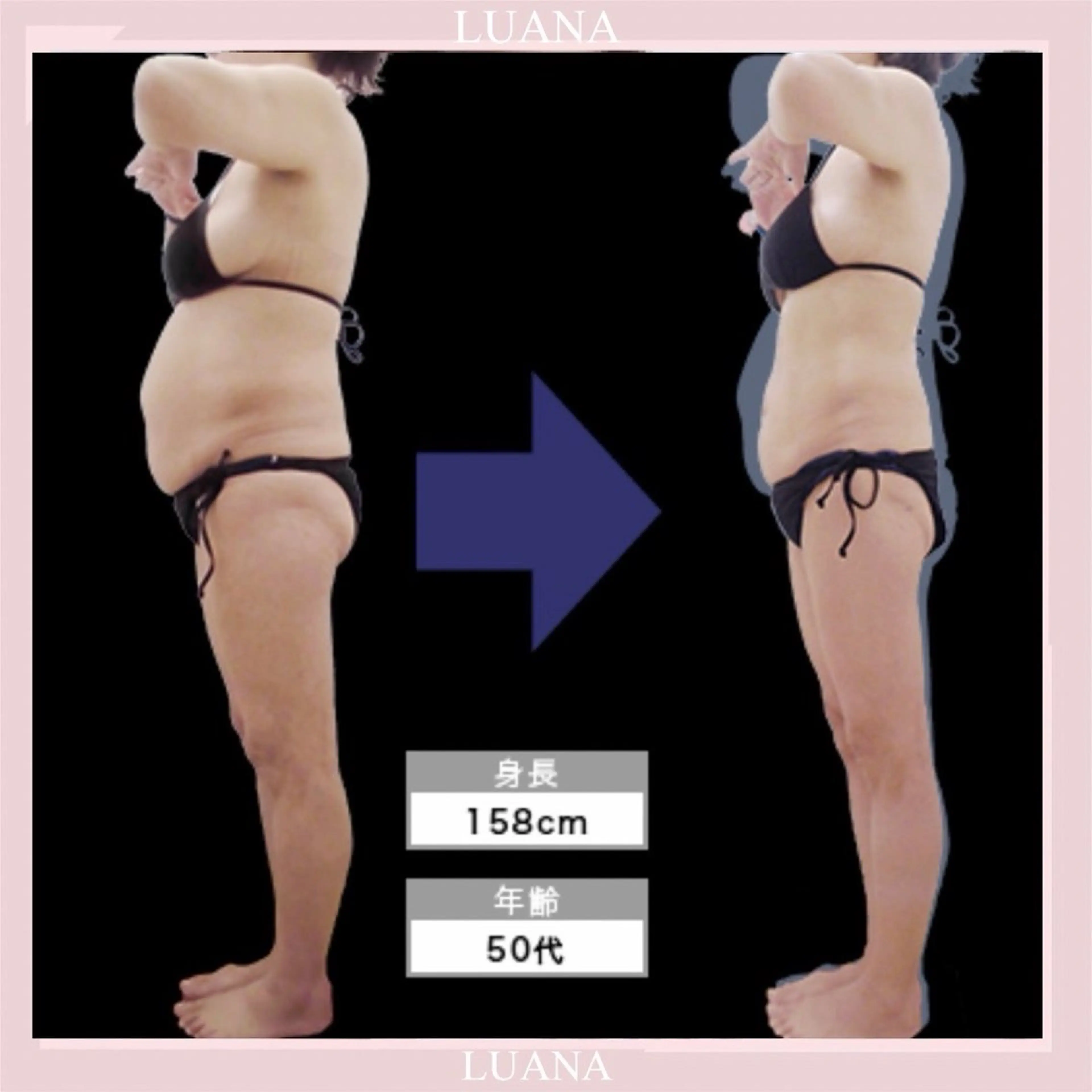 むくみ脂肪太りに！【全身痩身90分¥10000】　何度でも同価格◎の写真