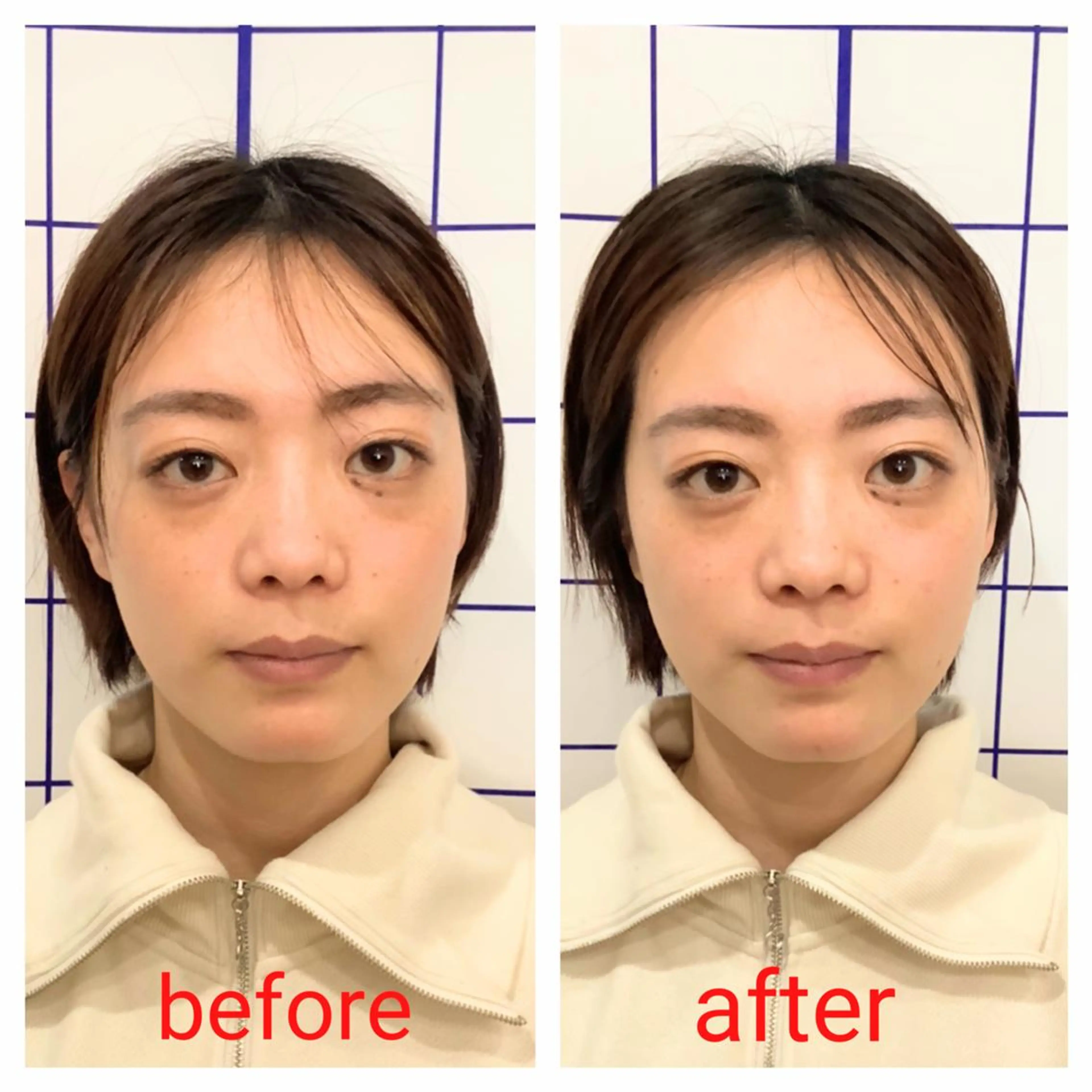 お顔のむくみたるみ 専門☆美容鍼小顔矯正のエステ・リラクイメージ