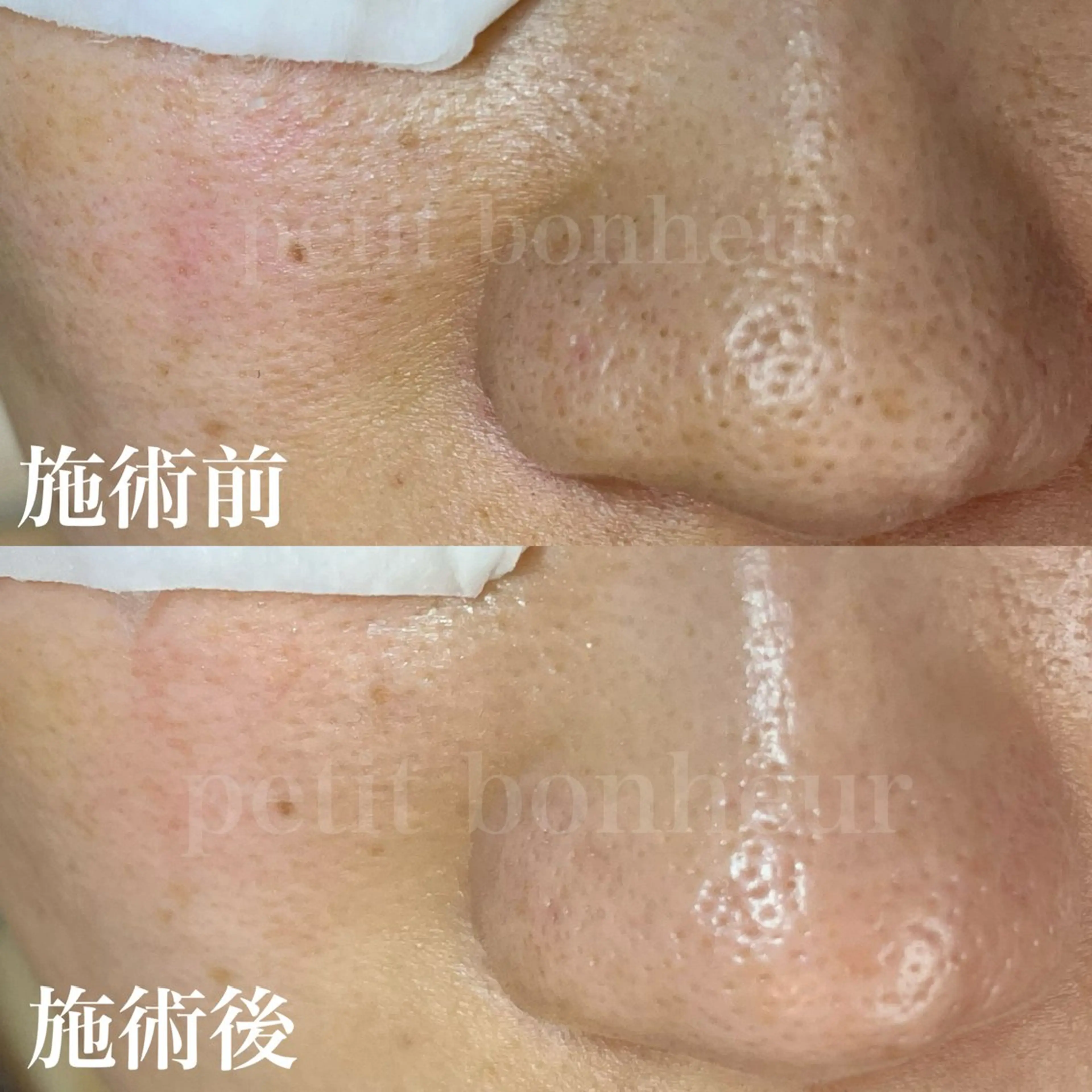 エステ 槙谷 あさみのエステ・リラクイメージ