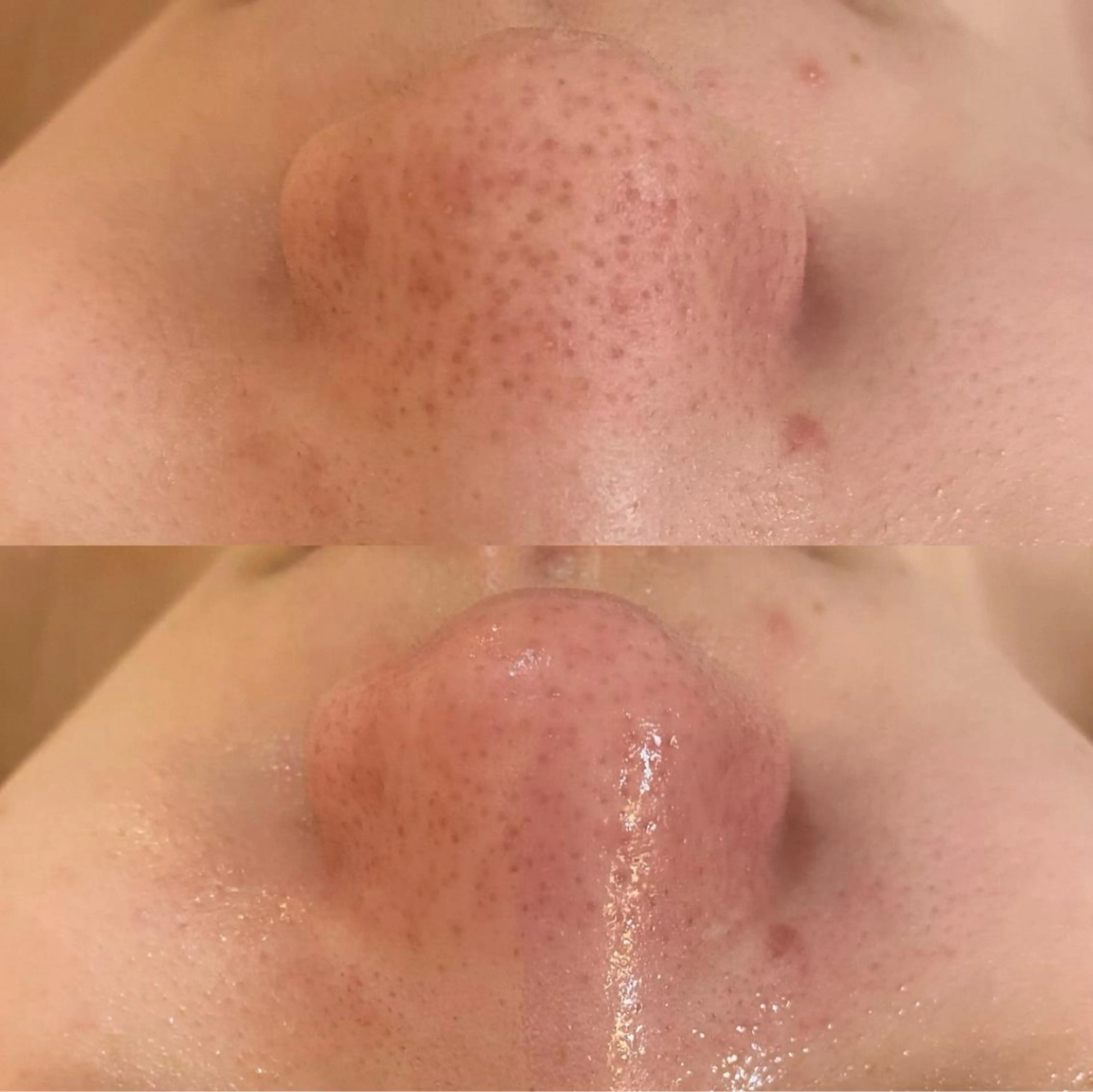 エステ リラク BELCIA福岡店 レコルトデベルシアのエステ・リラクイメージ