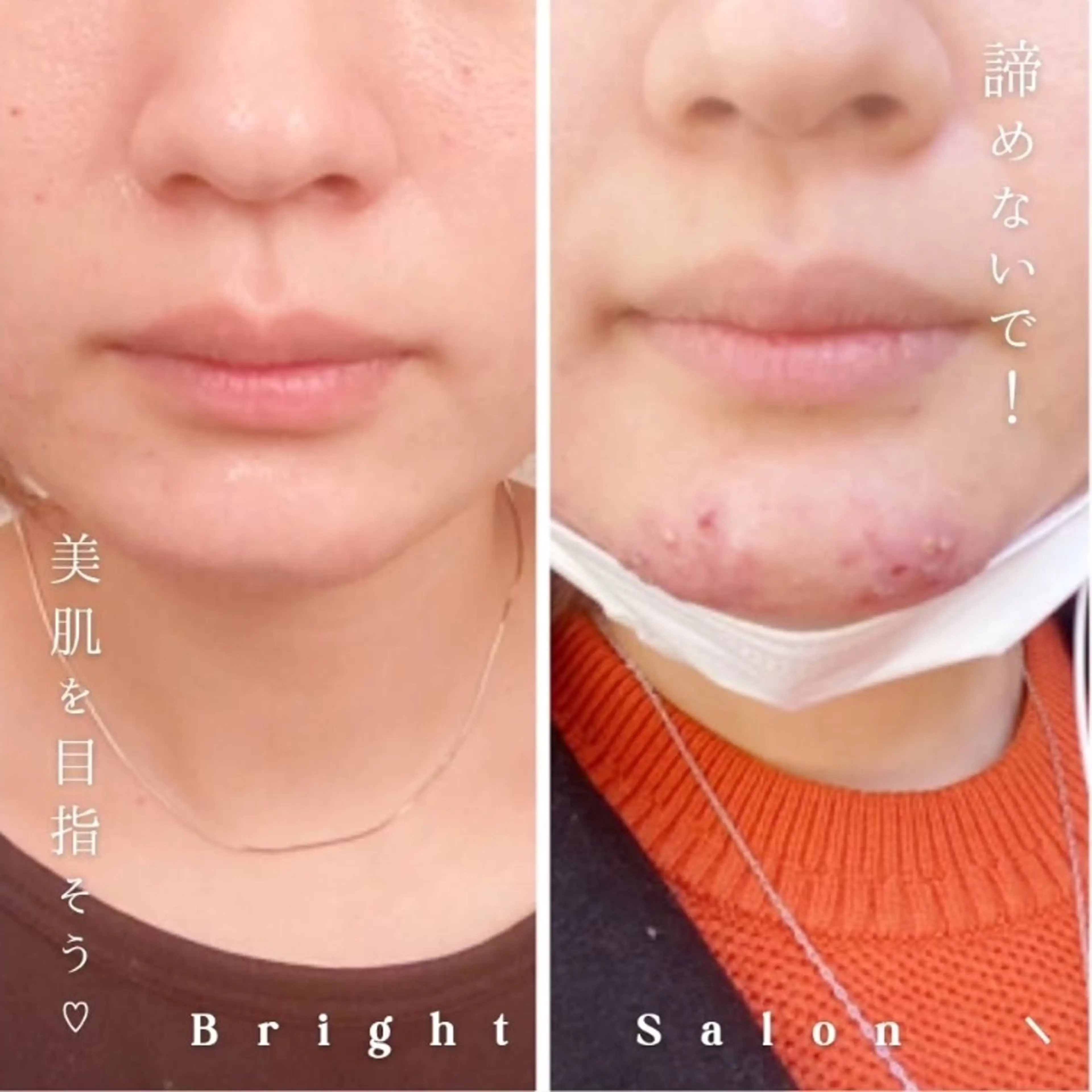 ブライトサロン所属・☆ブライトサロン☆ 東瑞希のエステ・リラクイメージ