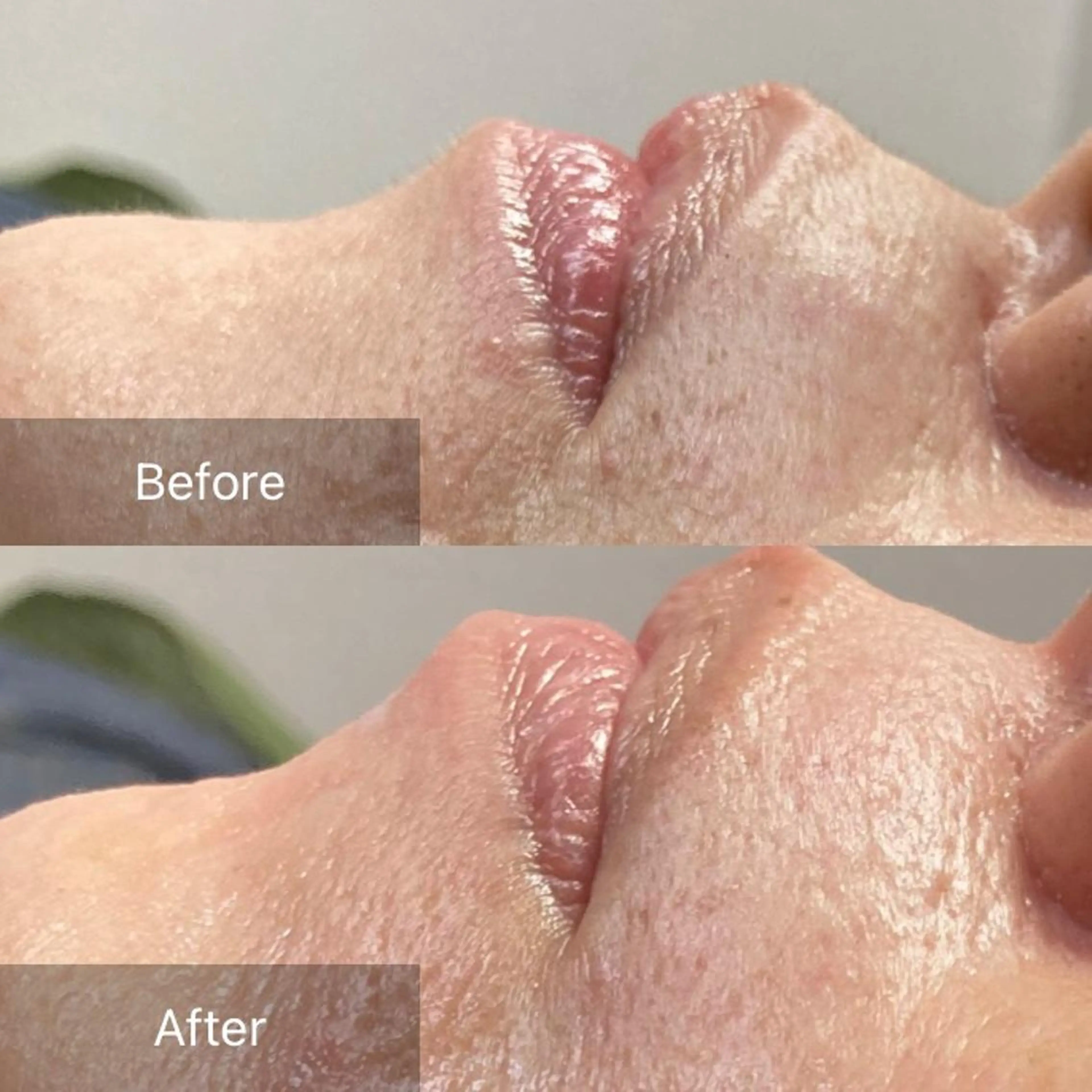 脱毛 産毛専門店 Bittoのエステ・リラクイメージ