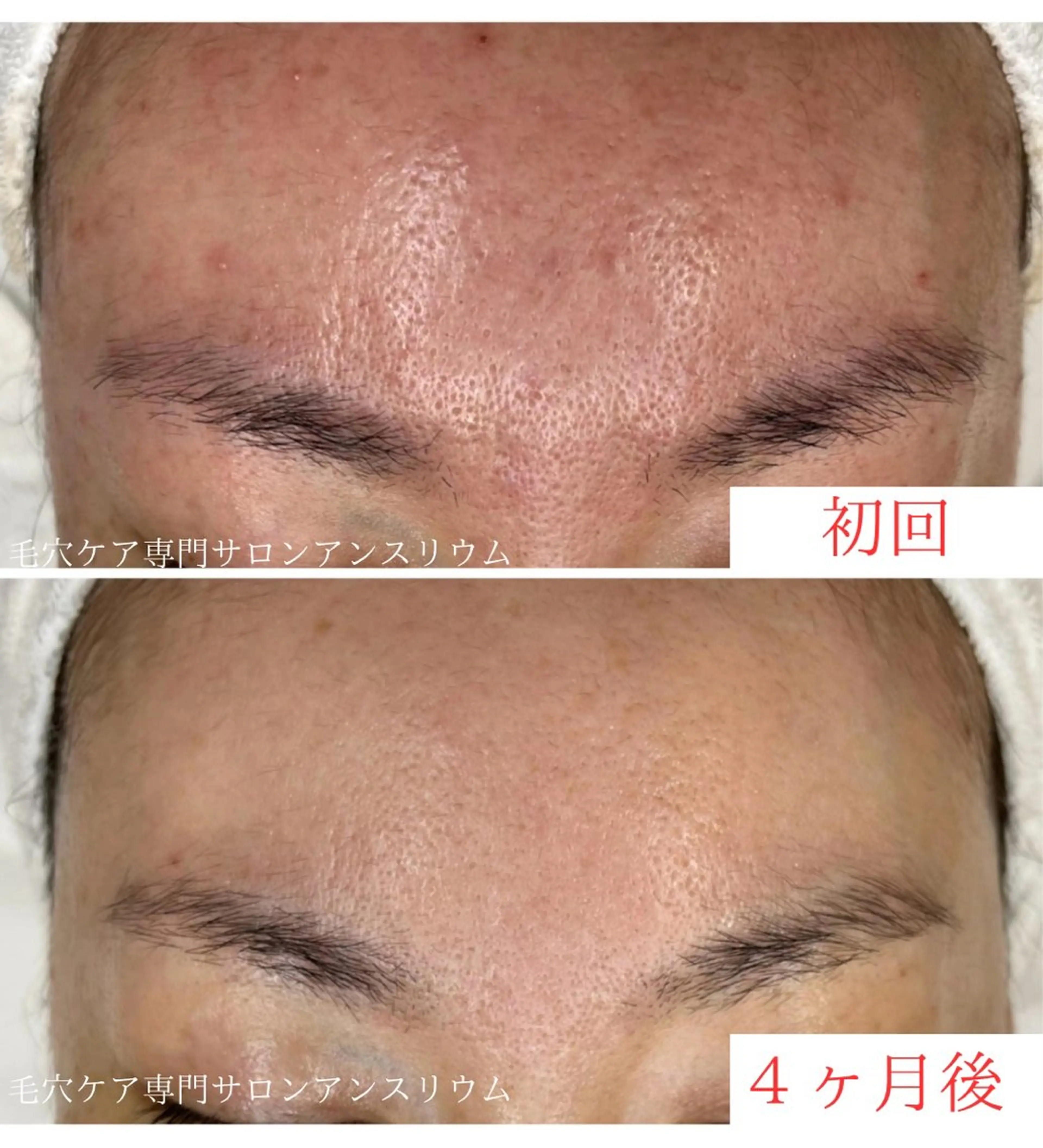 茨城土浦 つくば毛穴 ケア専門サロンのエステ・リラクイメージ