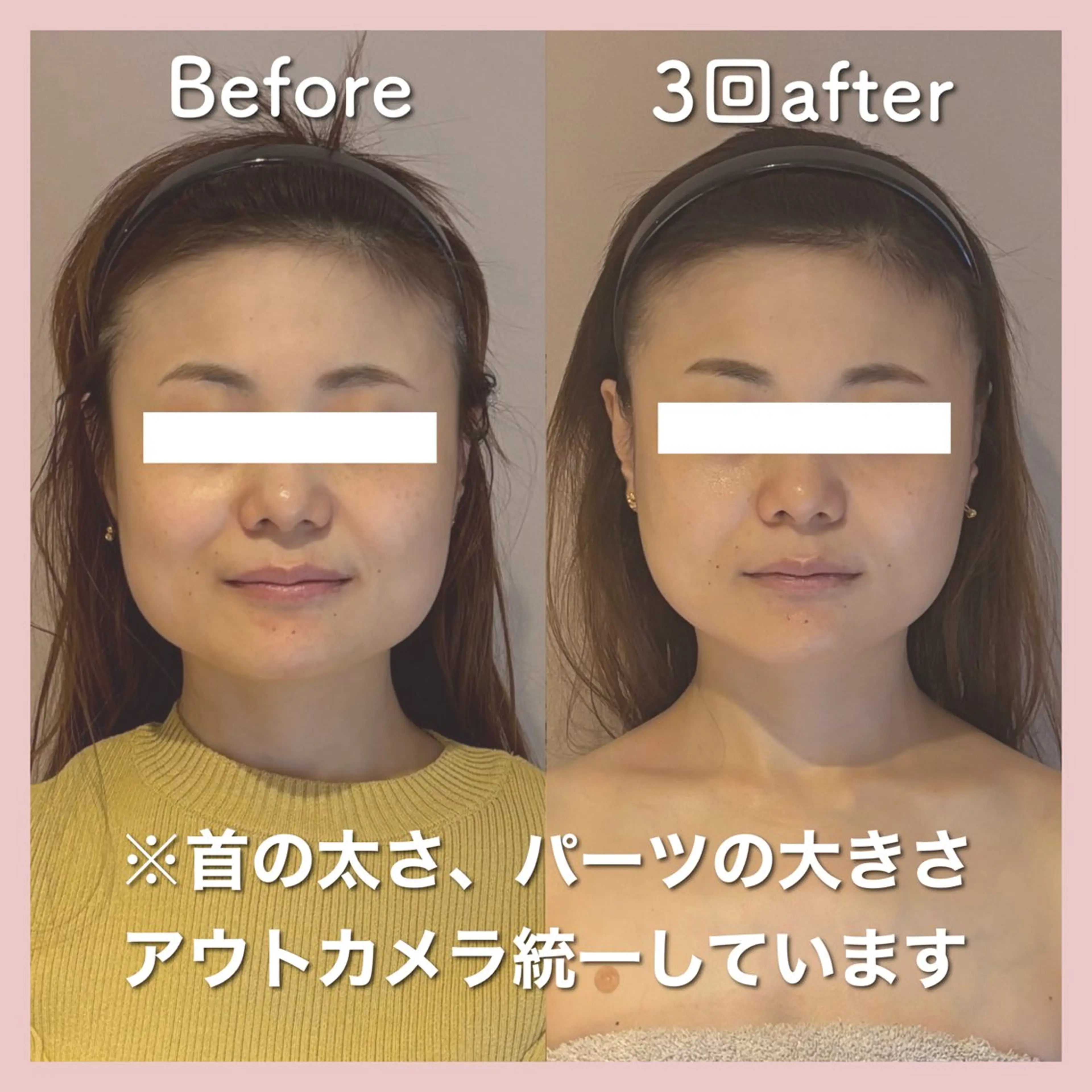 小顔矯正専門店Gémiey所属・越谷駅徒歩３分 小顔専門Gemieyのエステ・リラクイメージ