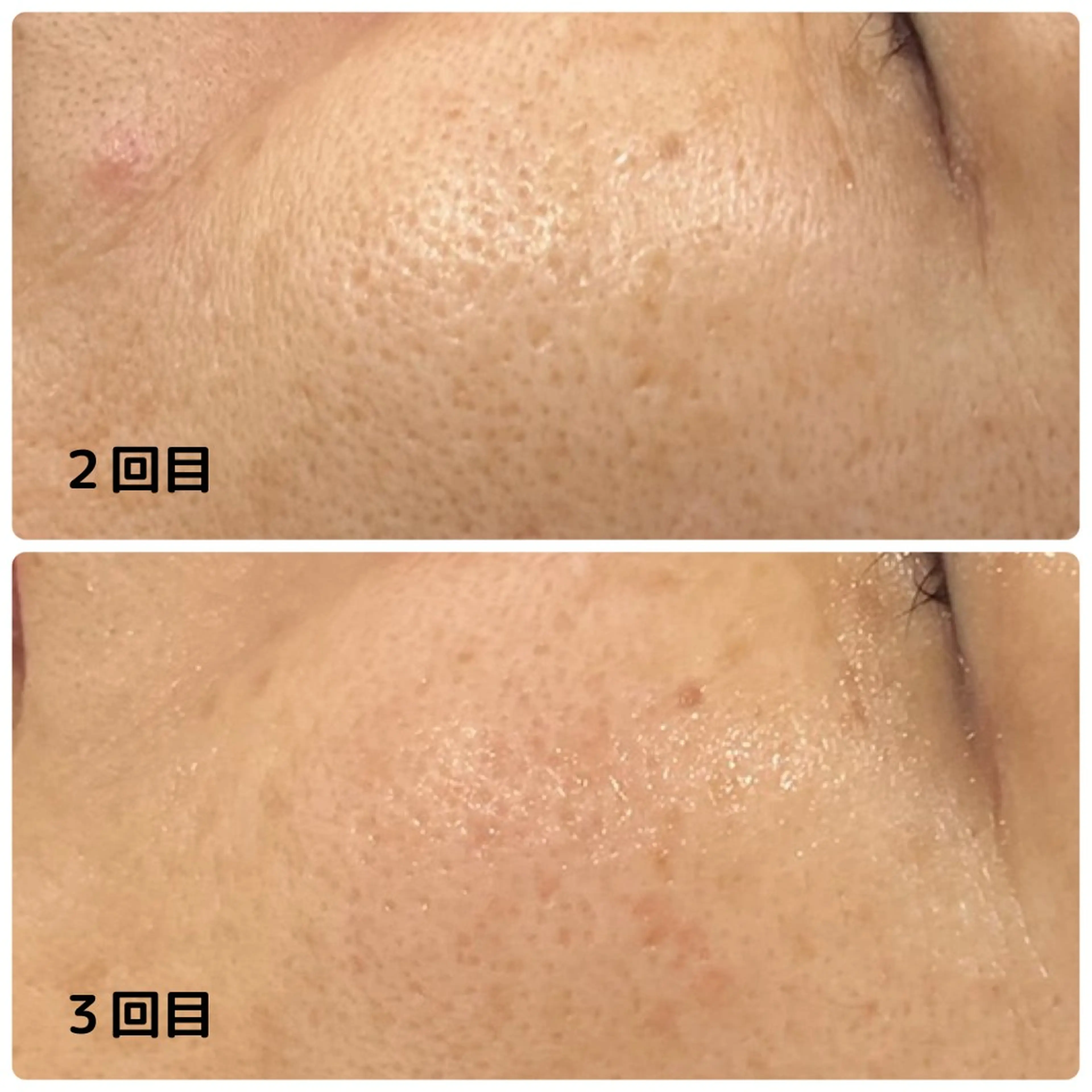 エステ Mia.rosa所属・光フェイシャル・脱毛 MIA.ROSAのエステ・リラクイメージ