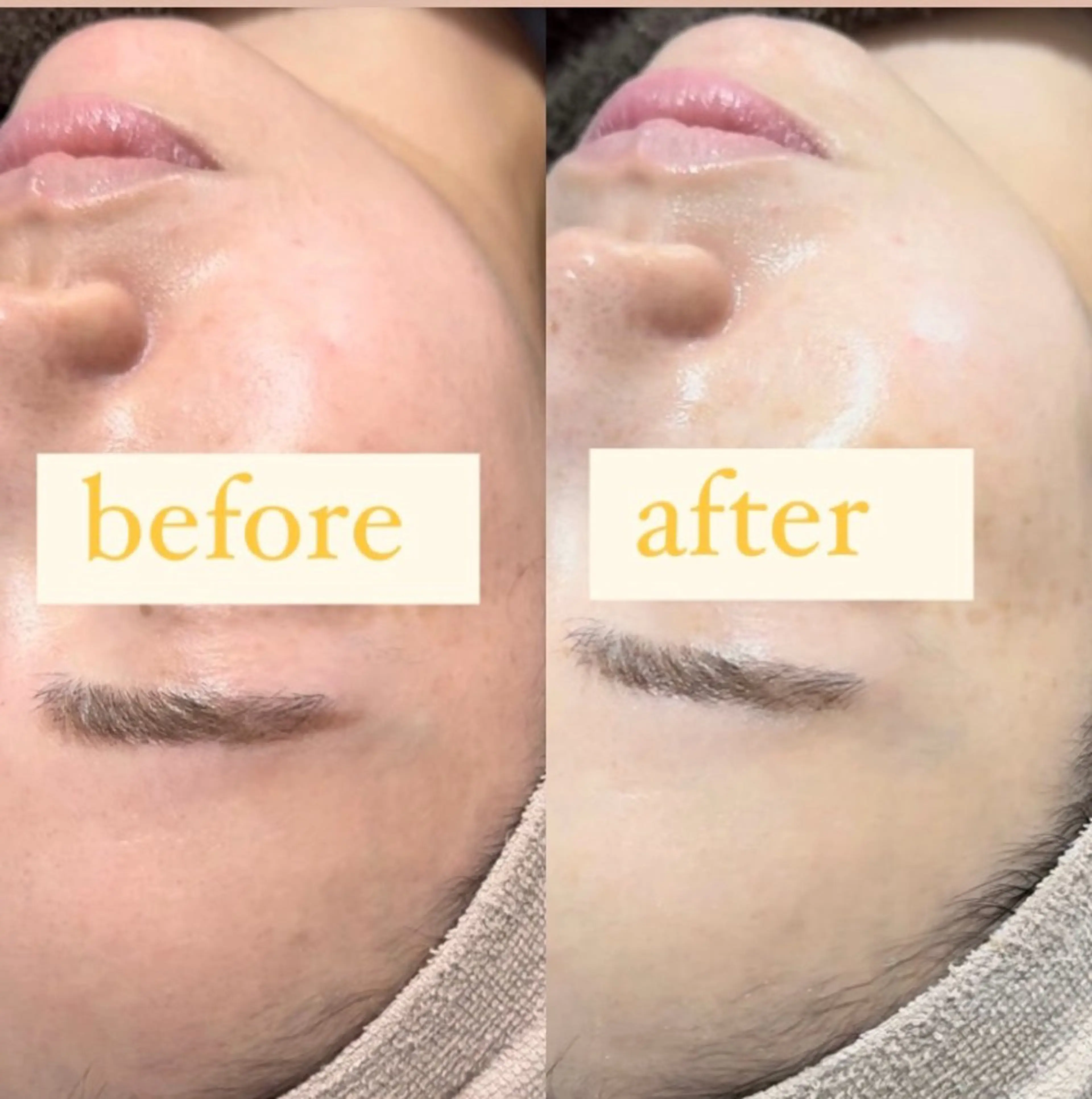 エステ リラク 【韓国肌管理・脱毛】 クレセントのその他イメージ