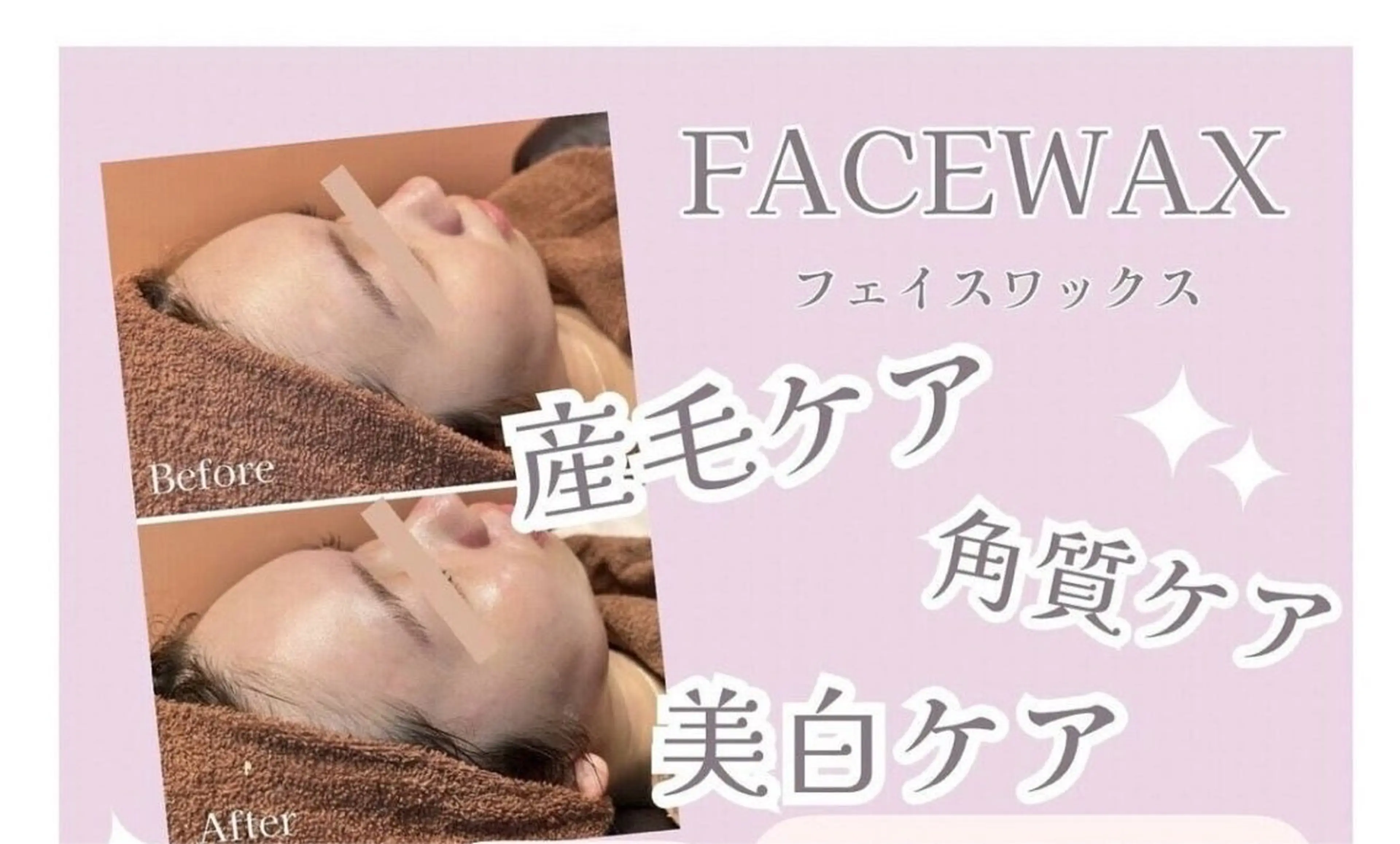 🌸フェイシャルWax（お顔全体の産毛を取ります☺️）🌸高濃度美容液&パック保湿付き❣️スキンケアの浸透レベルが変わるの写真