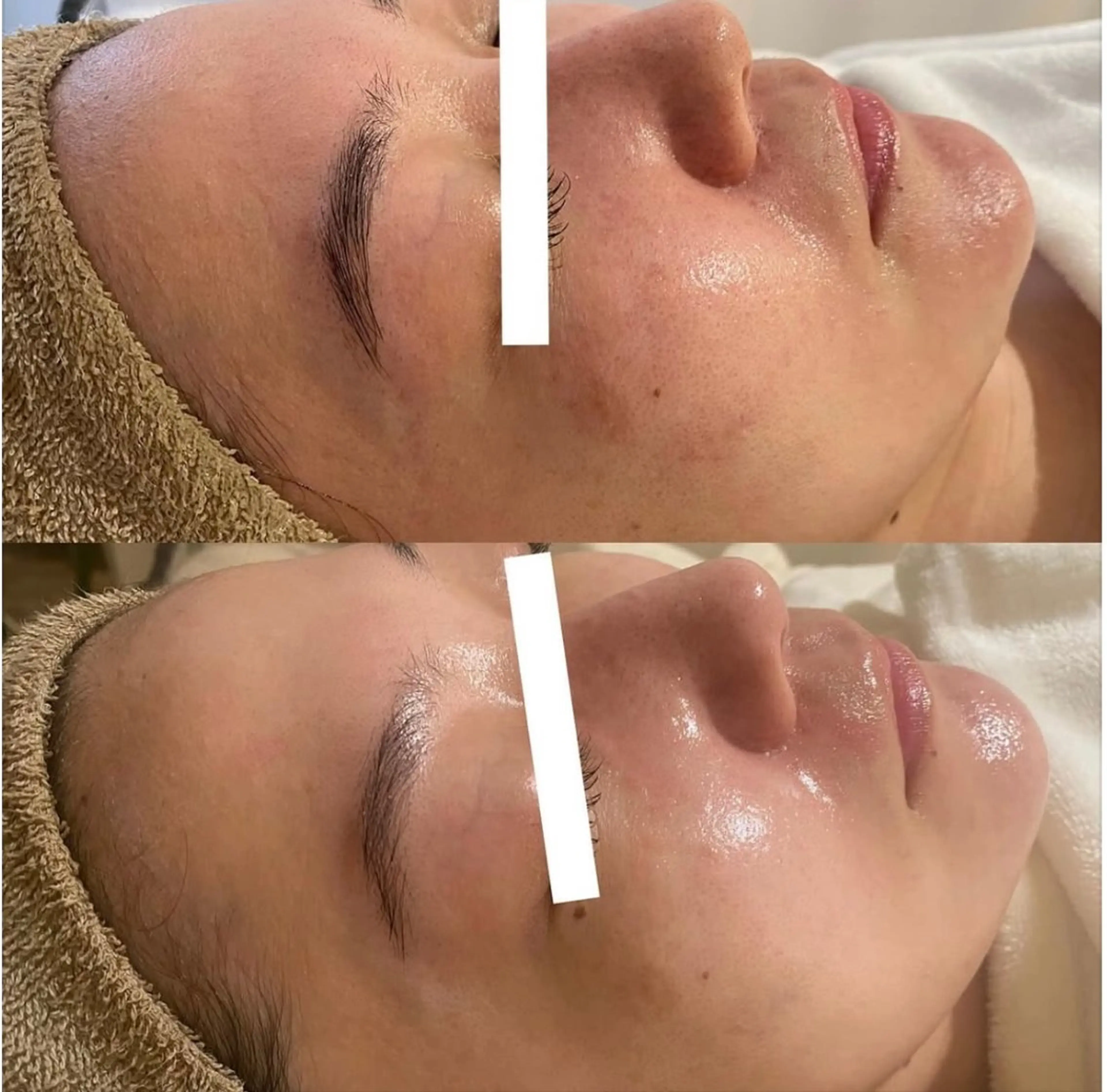 中目黒ハーブピーリン グ🌿ララピールのエステ・リラクイメージ