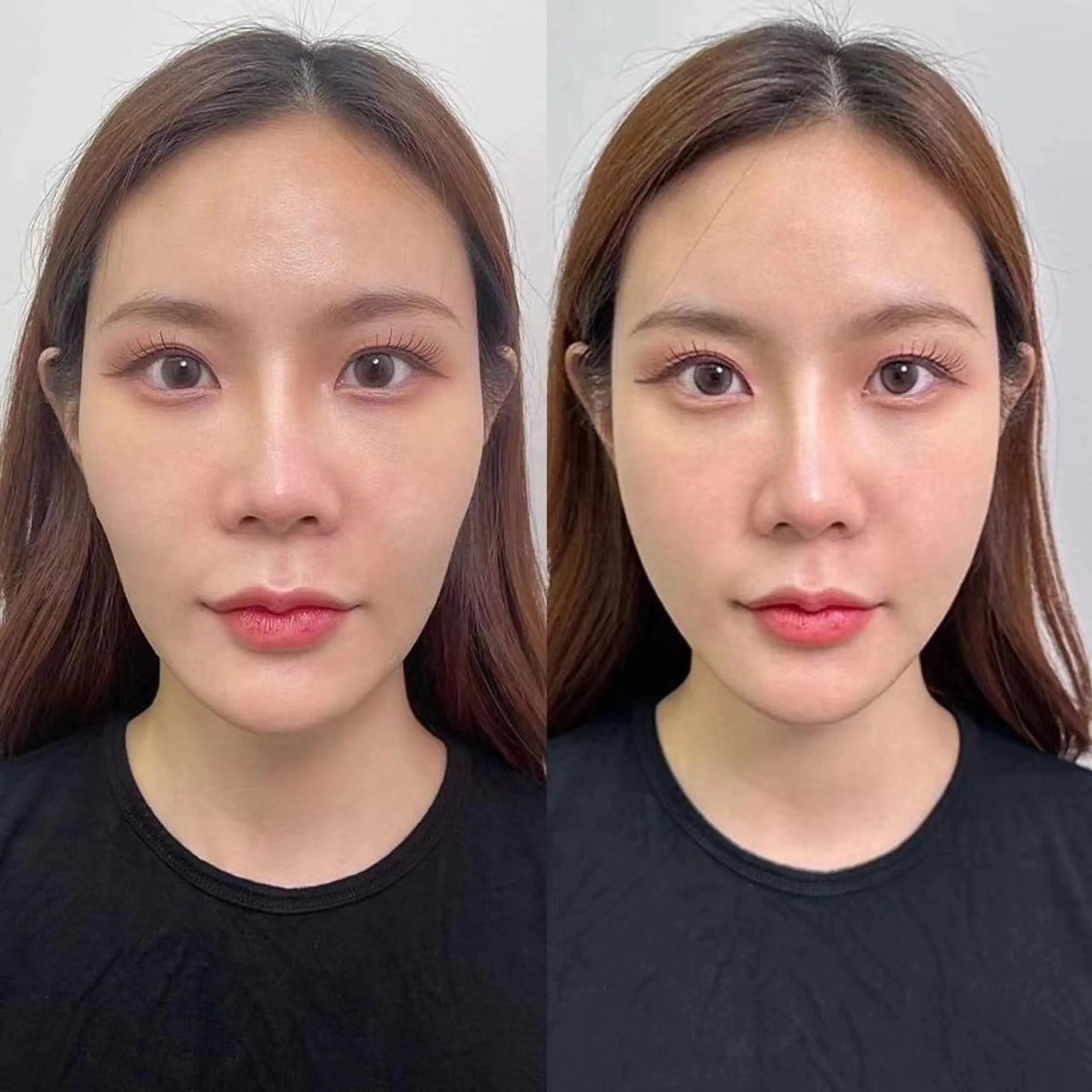 ネイル エステ aliaハーブ水光店 エステティシャン募集のエステ・リラクイメージ