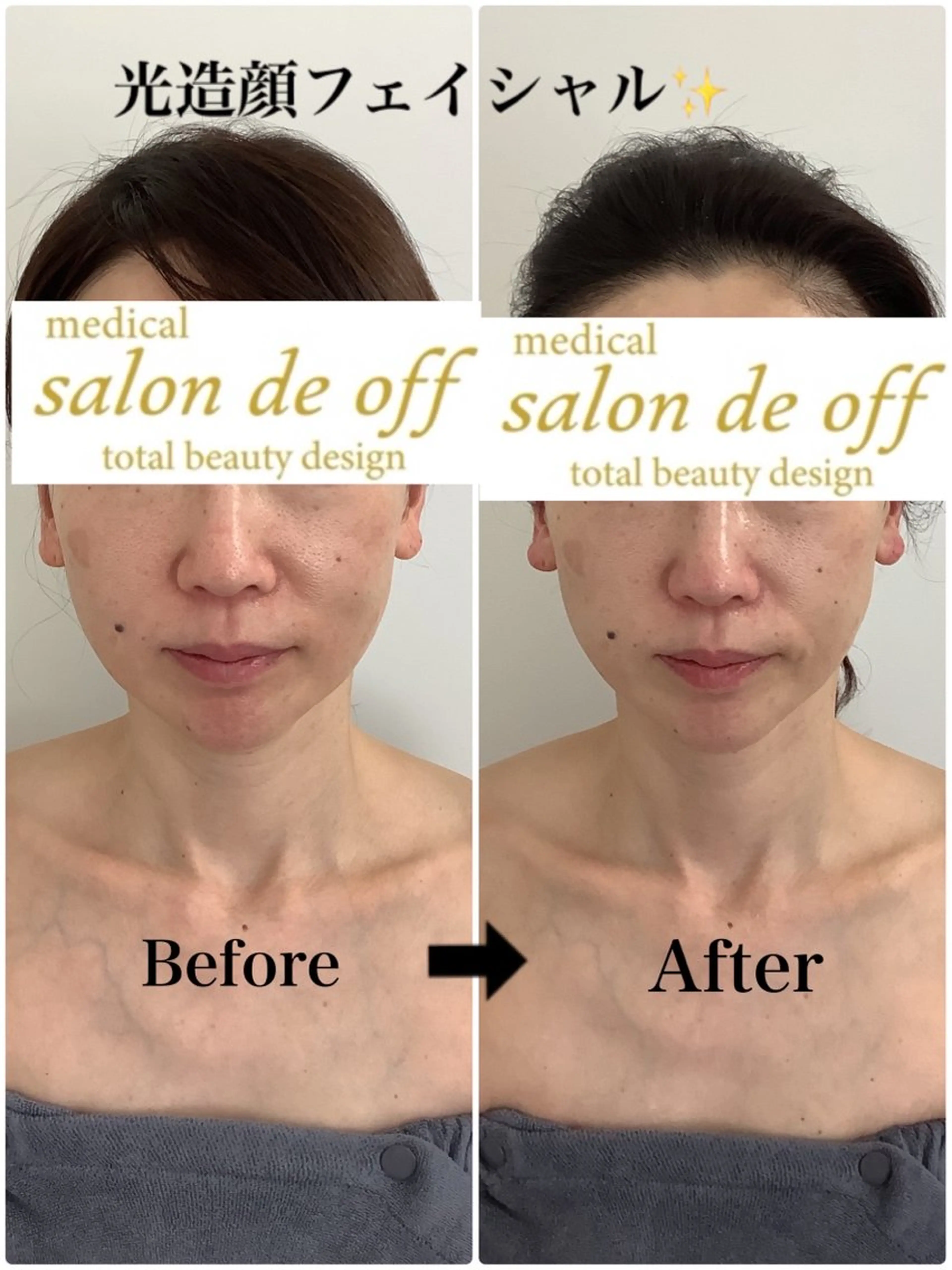 エステ リラク 🩵Tatsumi Kana🩵のエステ・リラクイメージ