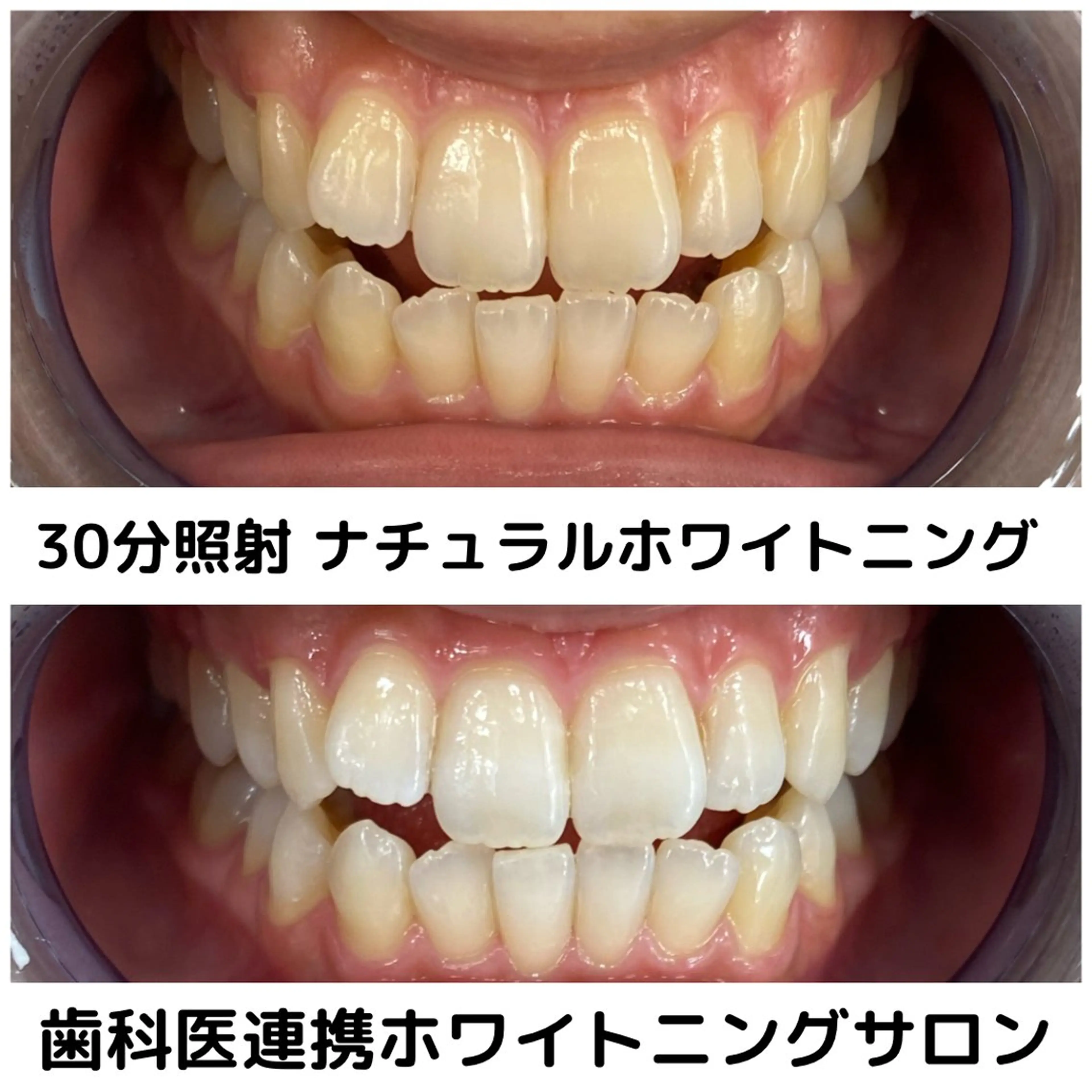 Platinum Beauty 四条烏丸店所属・吉田亮利 ホワイトニング専門店のその他イメージ