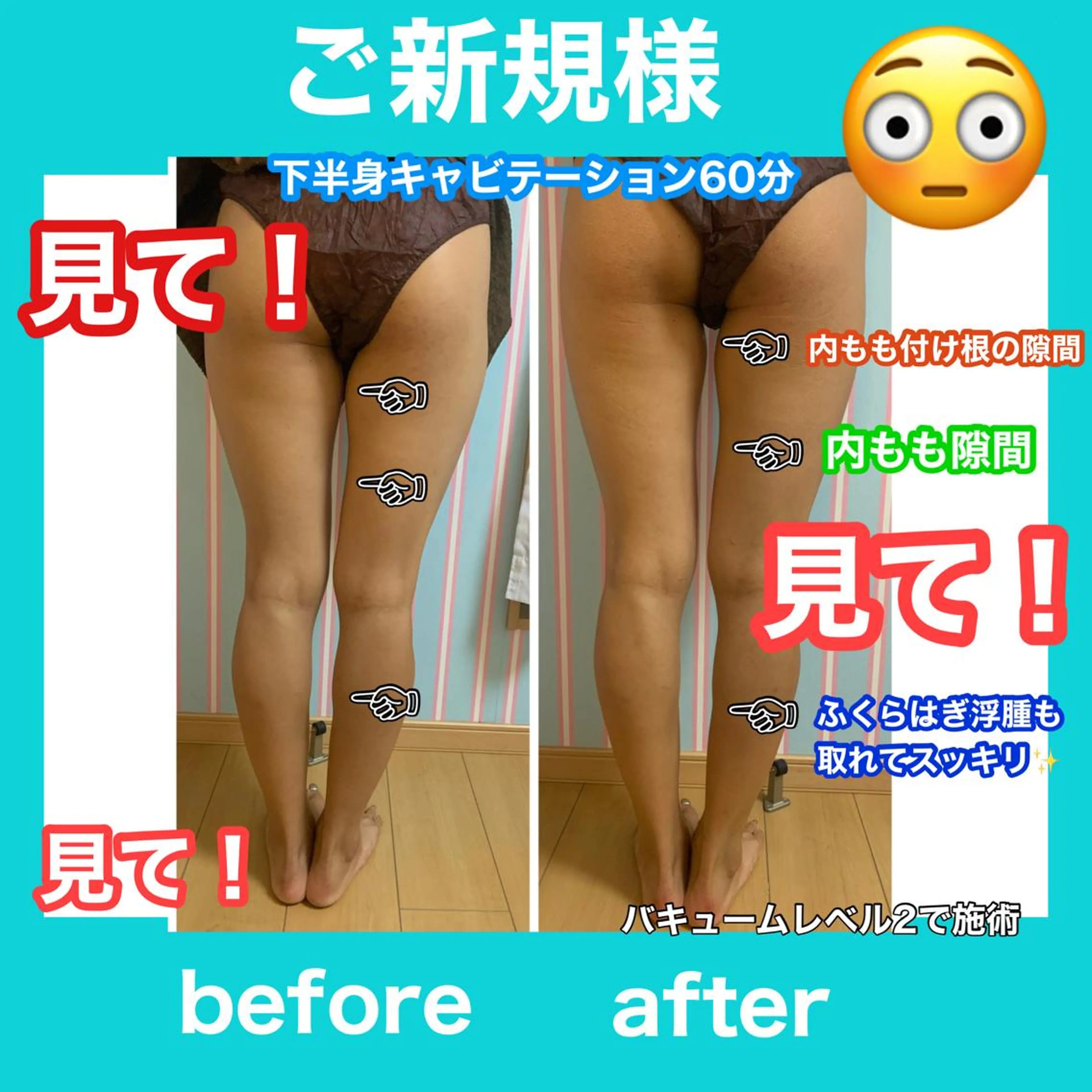 エステ リラク 痩身/脱毛/ネイル HARUKAのエステ・リラクイメージ