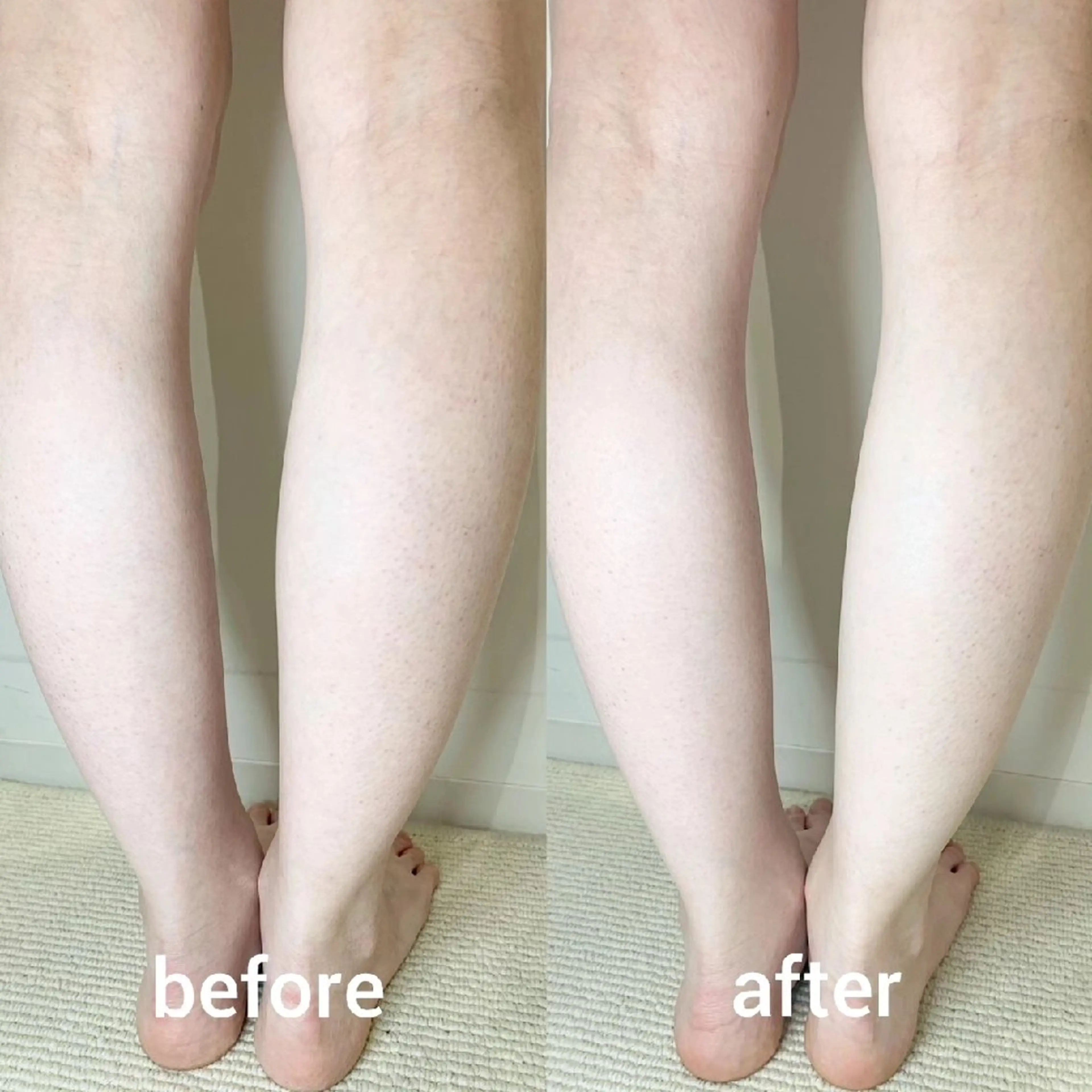 リラク ﾌｪｲｼｬﾙｴｽﾃ ﾗﾄｩｰﾙ伊深のエステ・リラクイメージ