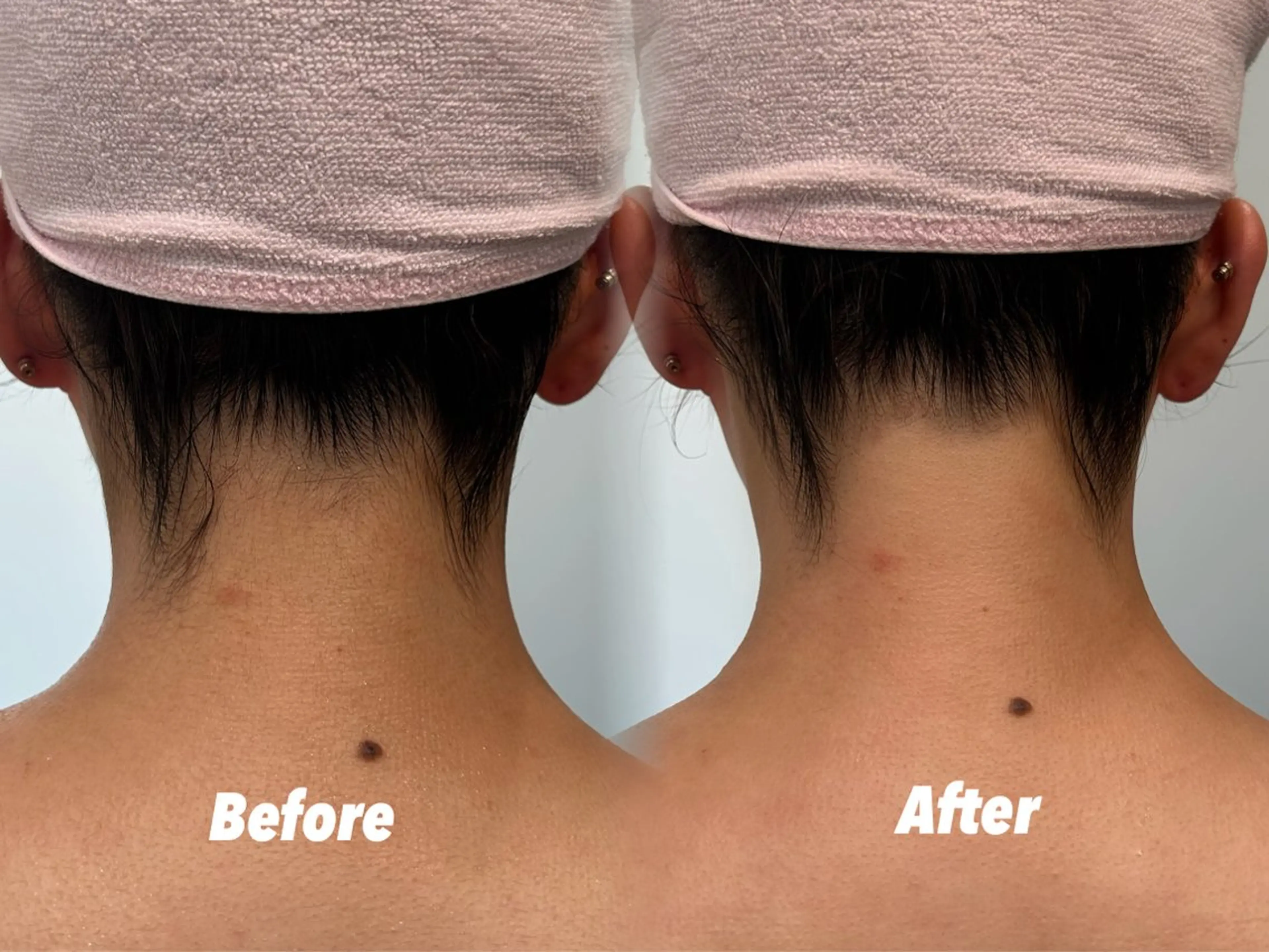 その他 🫧美しい素肌へ🫧 今成柚乃のその他イメージ