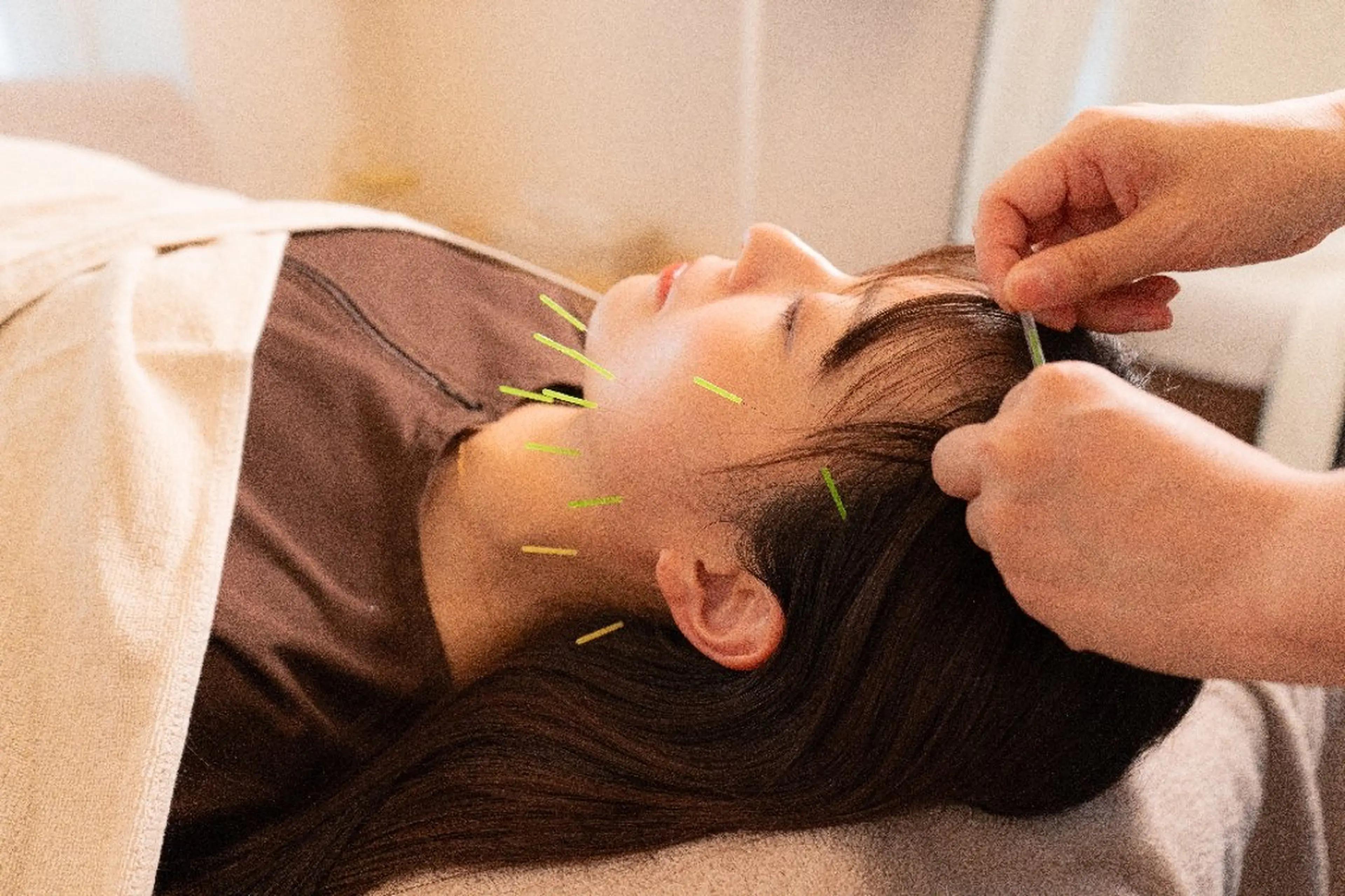 即効⚡小顔美容鍼🪡 むくみたるみ脂肪解消のエステ・リラクイメージ