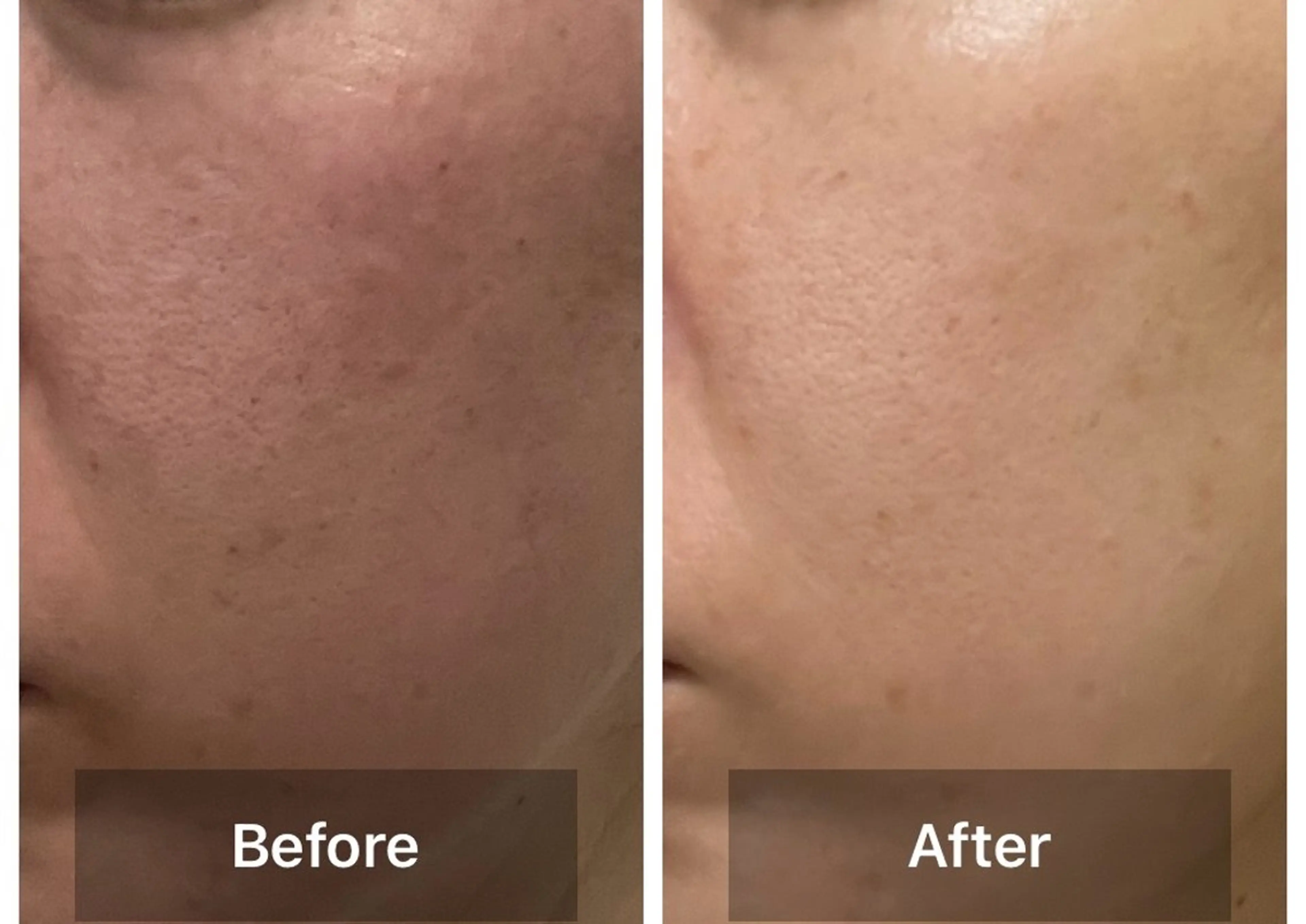 サクッと30分💆‍♀️ “30分でつるん肌”ハーブケアの写真