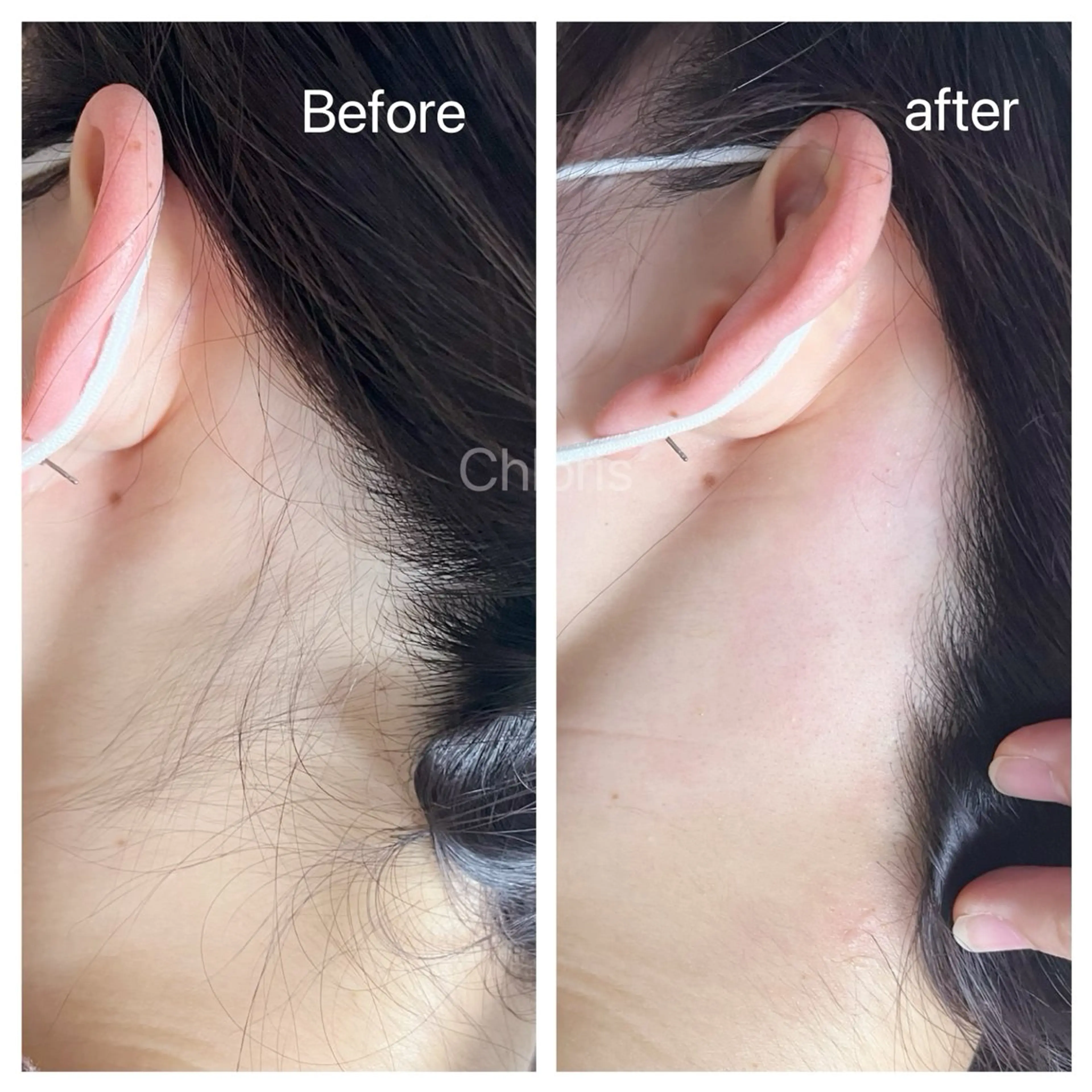 川越デリケートゾーン 光脱毛/ワックス脱毛のエステ・リラクイメージ