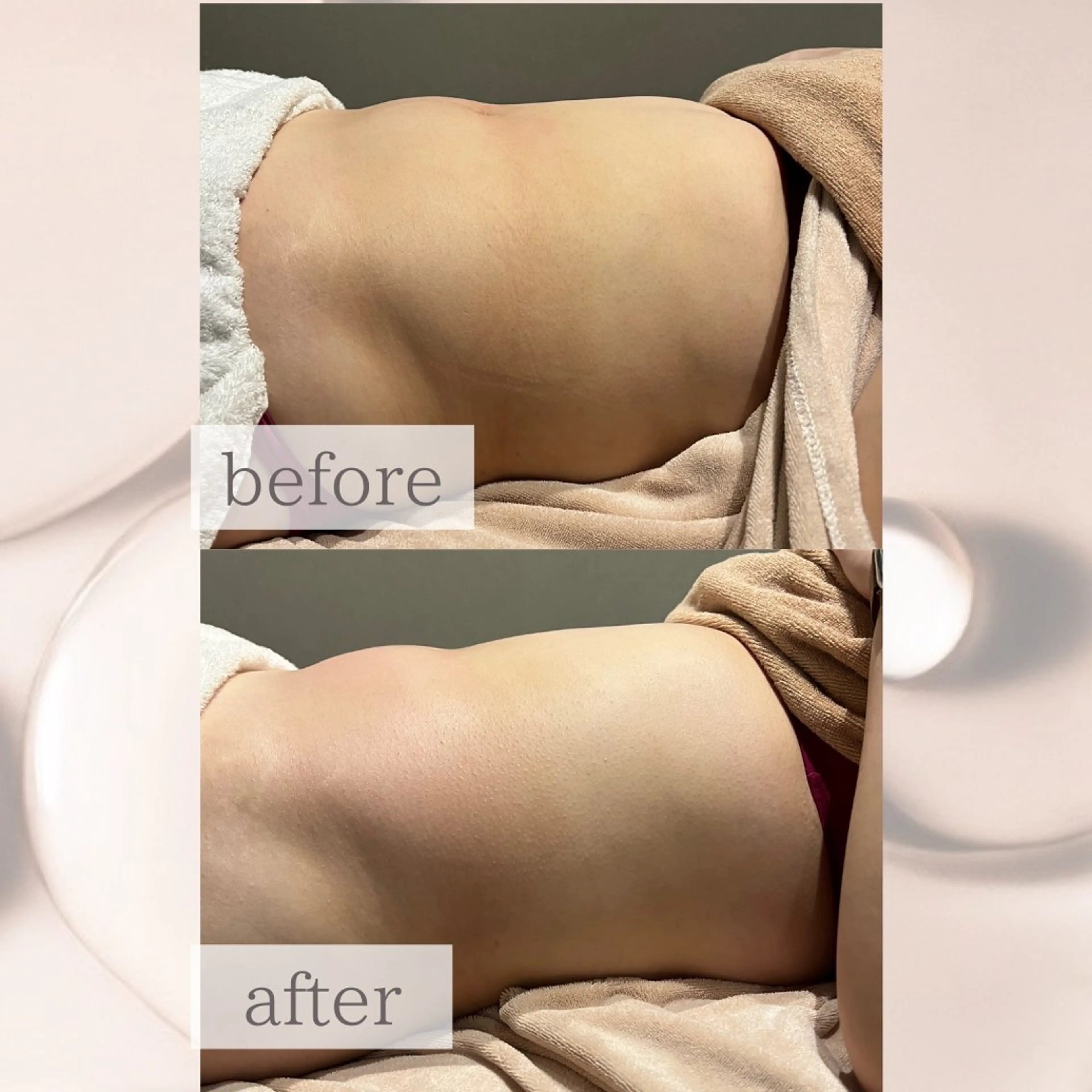 【vidyto】ヴィディトゥ所属・肌管理サロン vidyto　MOEのエステ・リラクイメージ