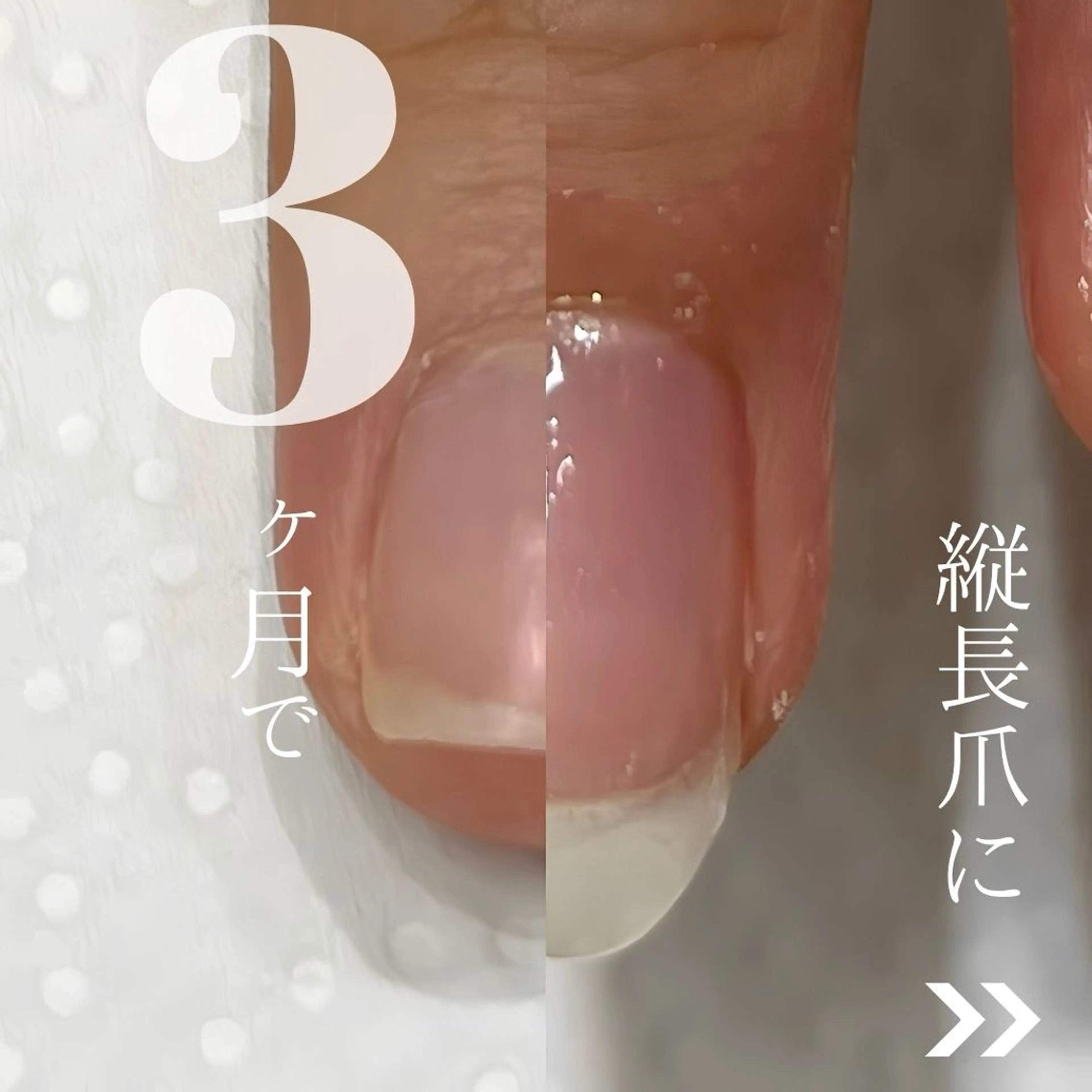 ネイル soa.Aika 自爪育成のネイルデザイン