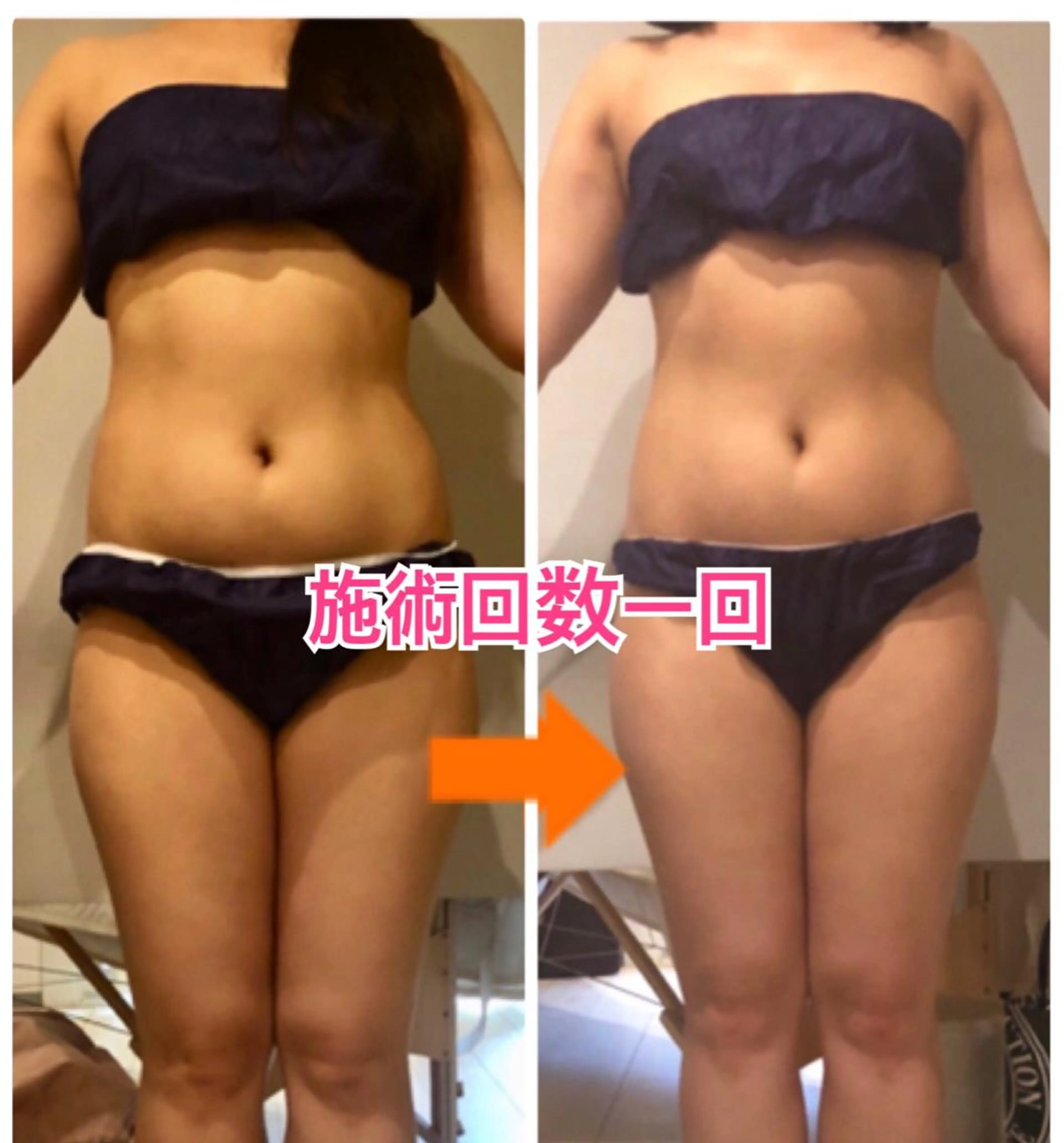 ショート カラー パーマ ヘアアレンジ メンズ キッズ ネイル マツエク・マツパ ‍痩身＆ボディ 結果出し🌟丹野のエステ・リラクイメージ