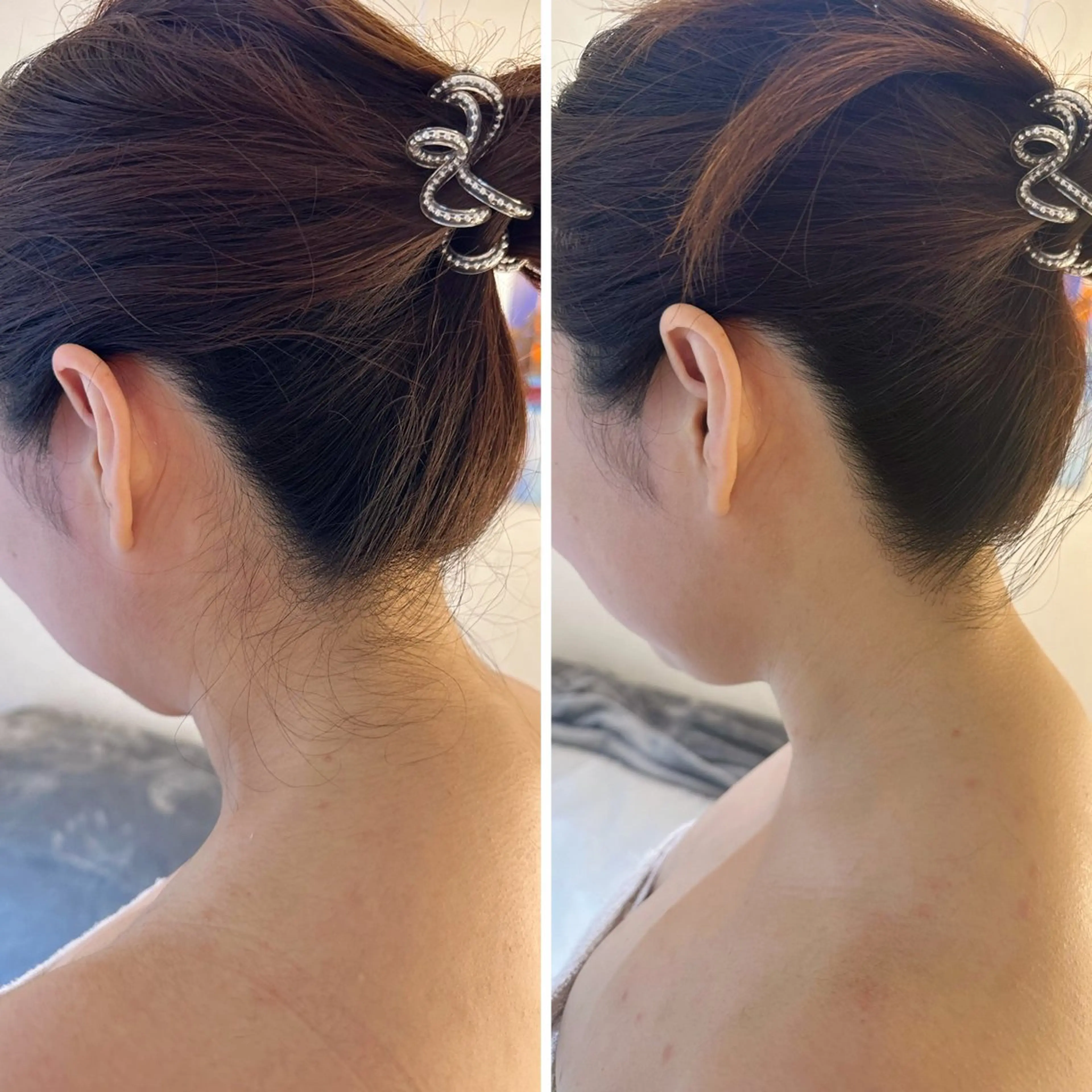 脱毛 うなじ脱毛/美肌脱毛 LABELのエステ・リラクイメージ