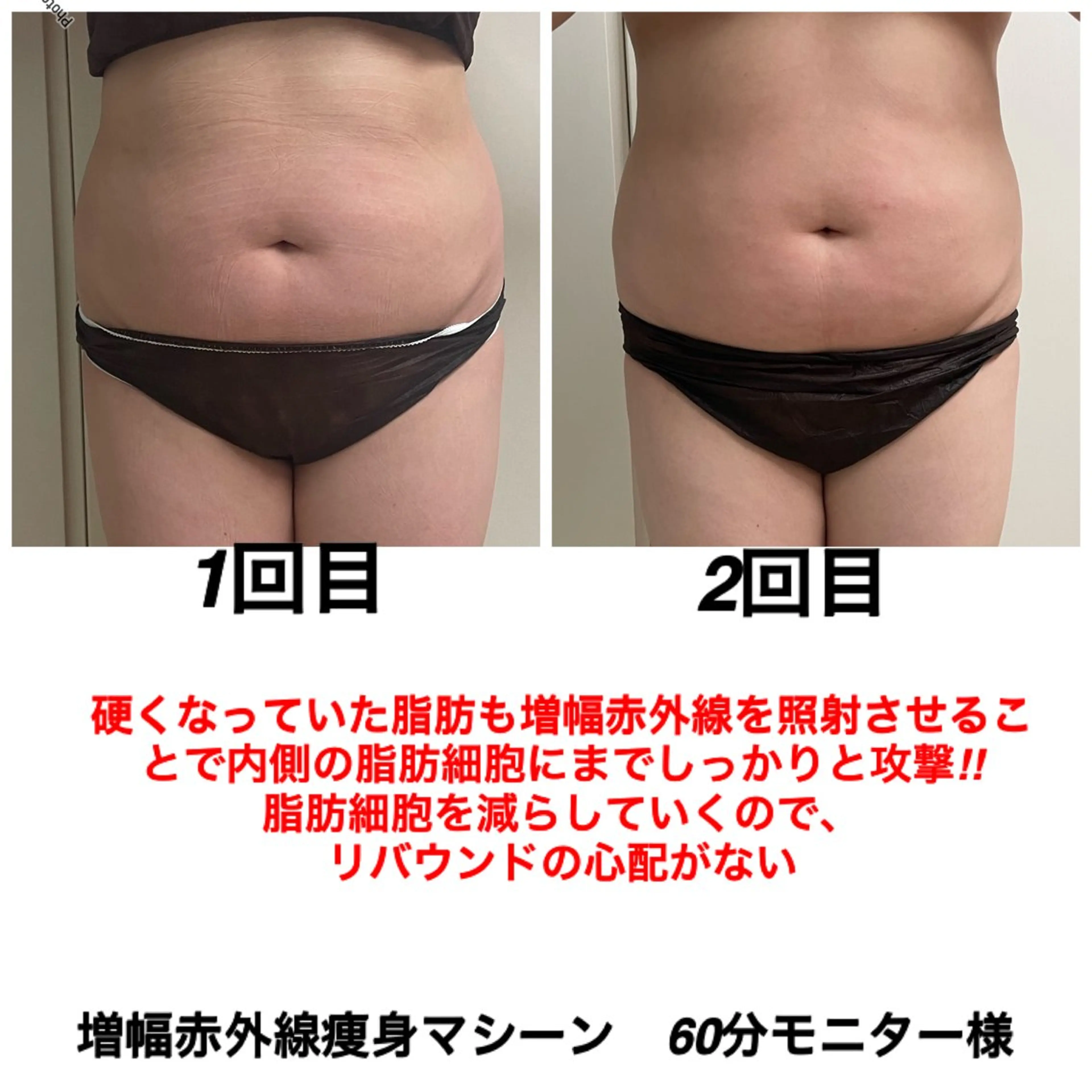 エステ ネイル・エステサロン UILANIのネイルデザイン