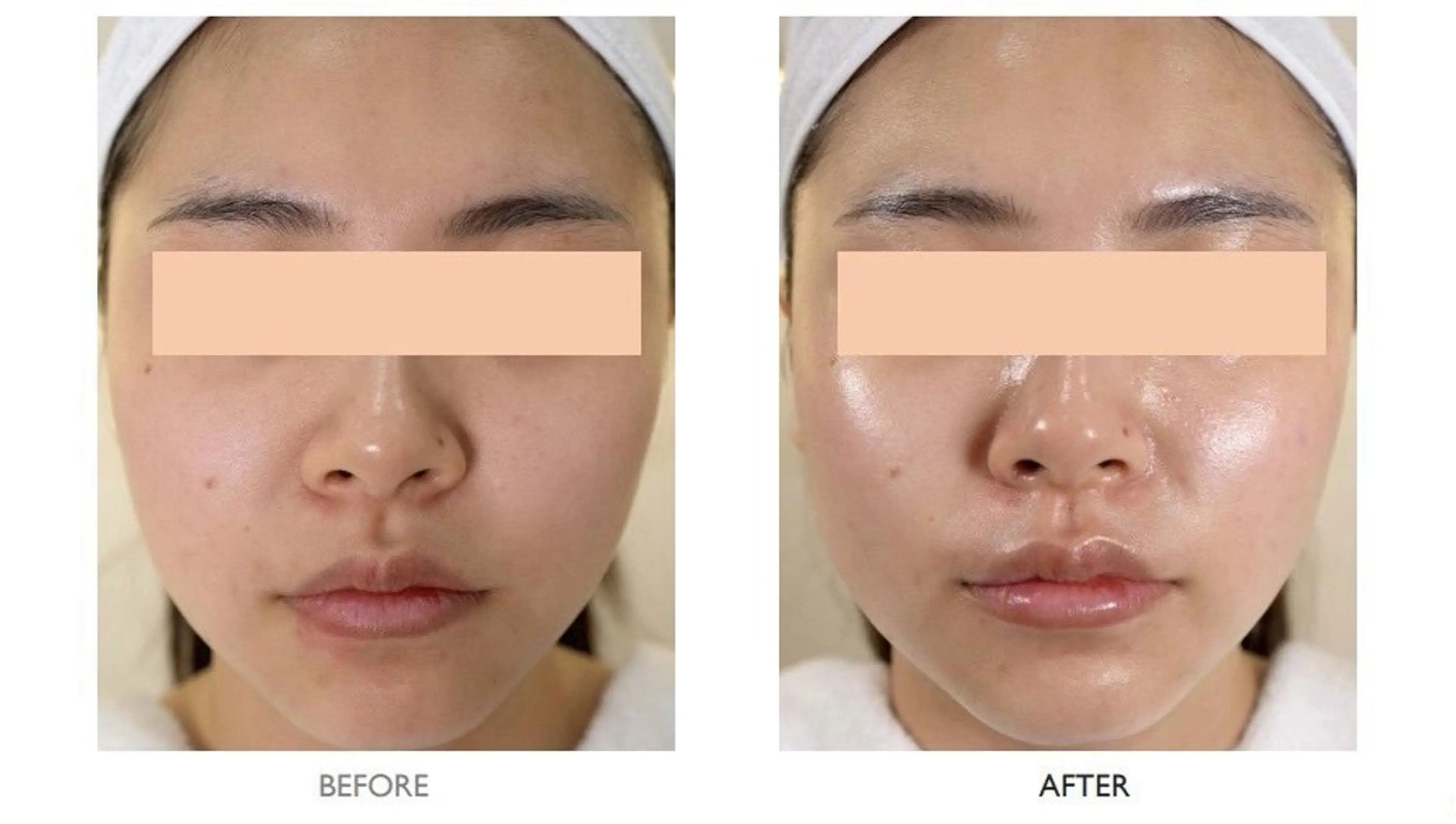 🎀韓国肌管理🎀 Mikiのエステ・リラクイメージ