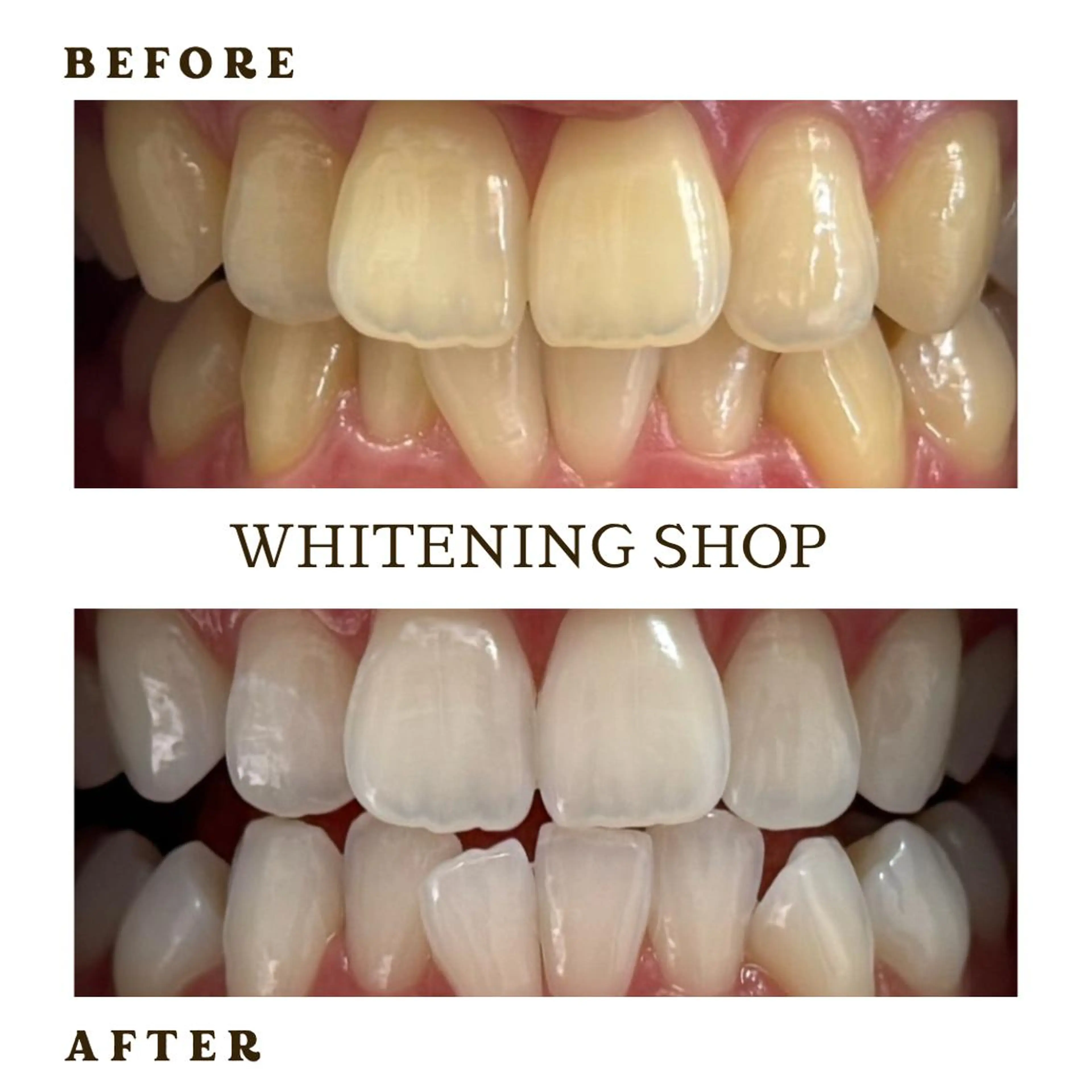 メンズ その他 ホワイトニング ショップ葛西店のその他イメージ