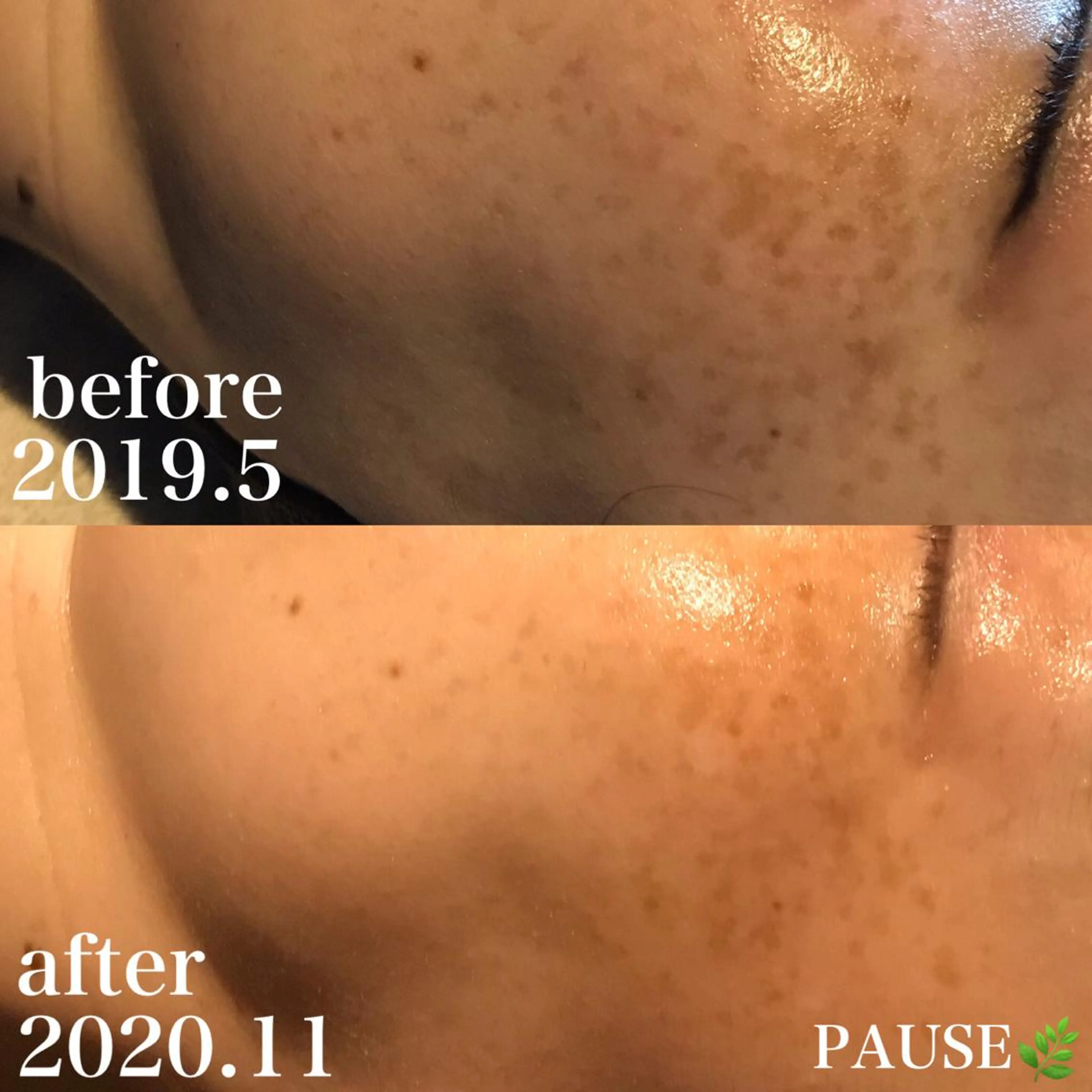 エステ 浜野 恵美のエステ・リラクイメージ