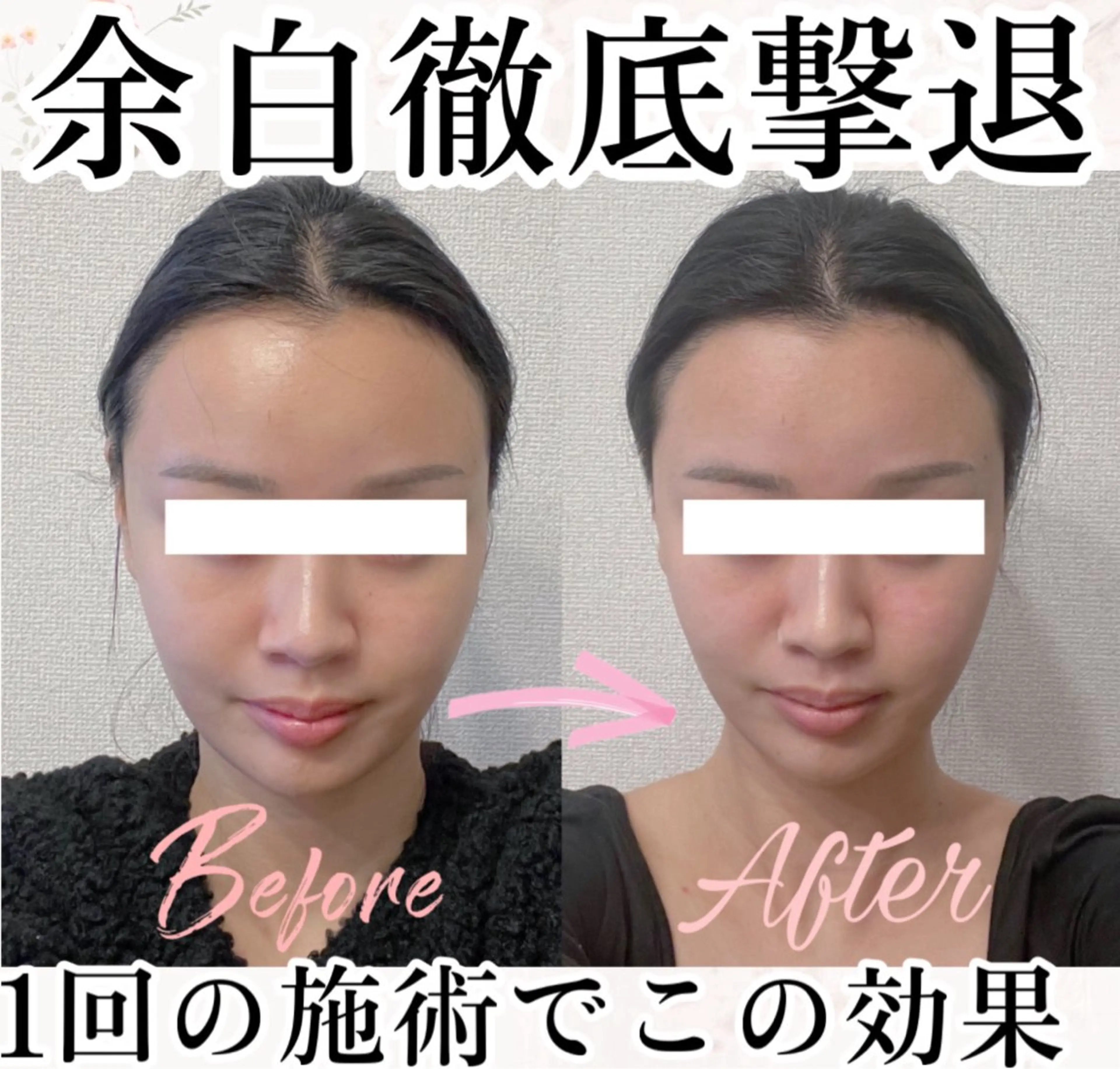 小顔矯正専門サロンAxiune所属・小顔矯正専門 🪽アシュネ平野のエステ・リラクイメージ