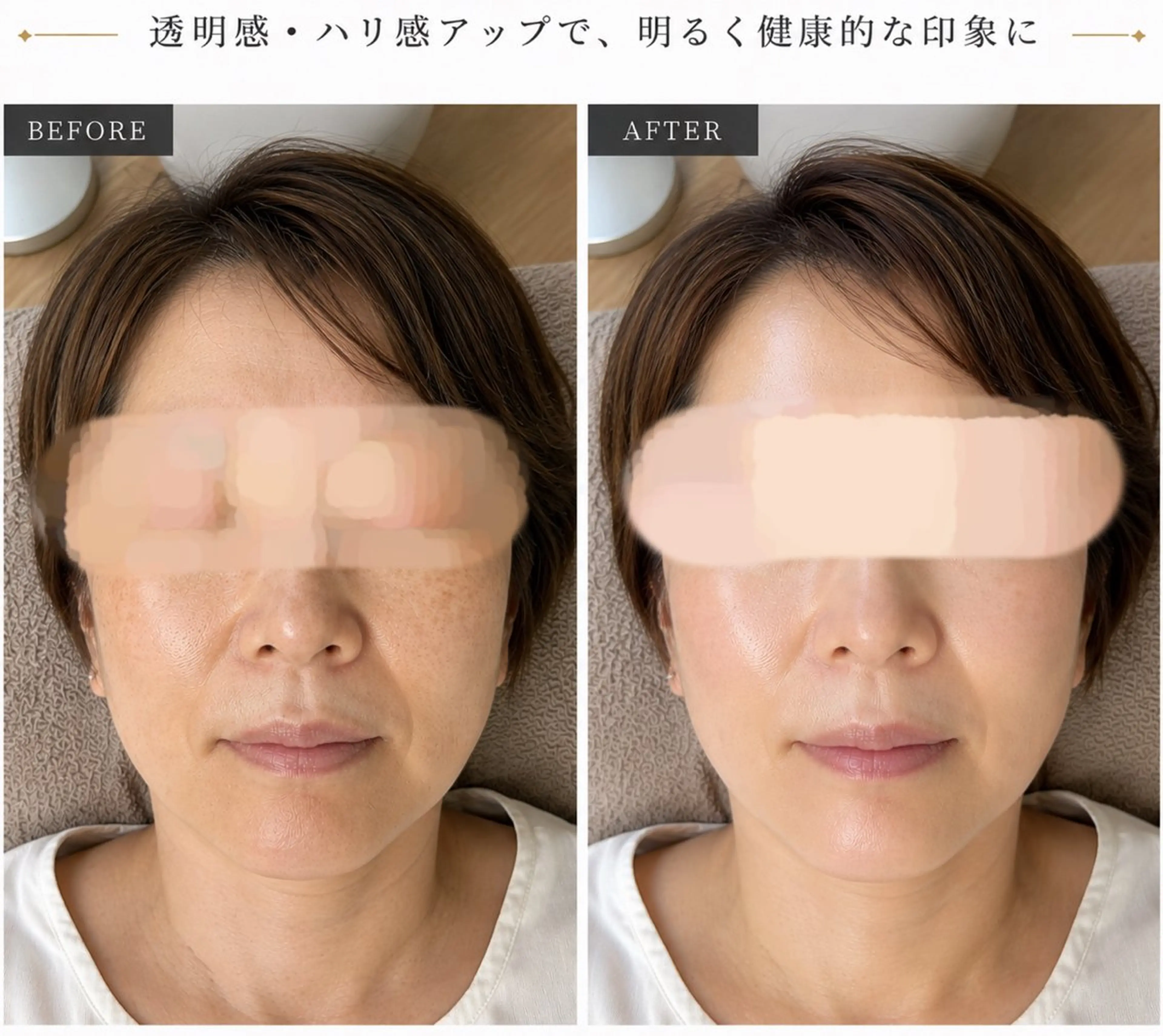 本気の肌質改善🌿肌生まれ変わりGREEN PEEL 【5days】の写真