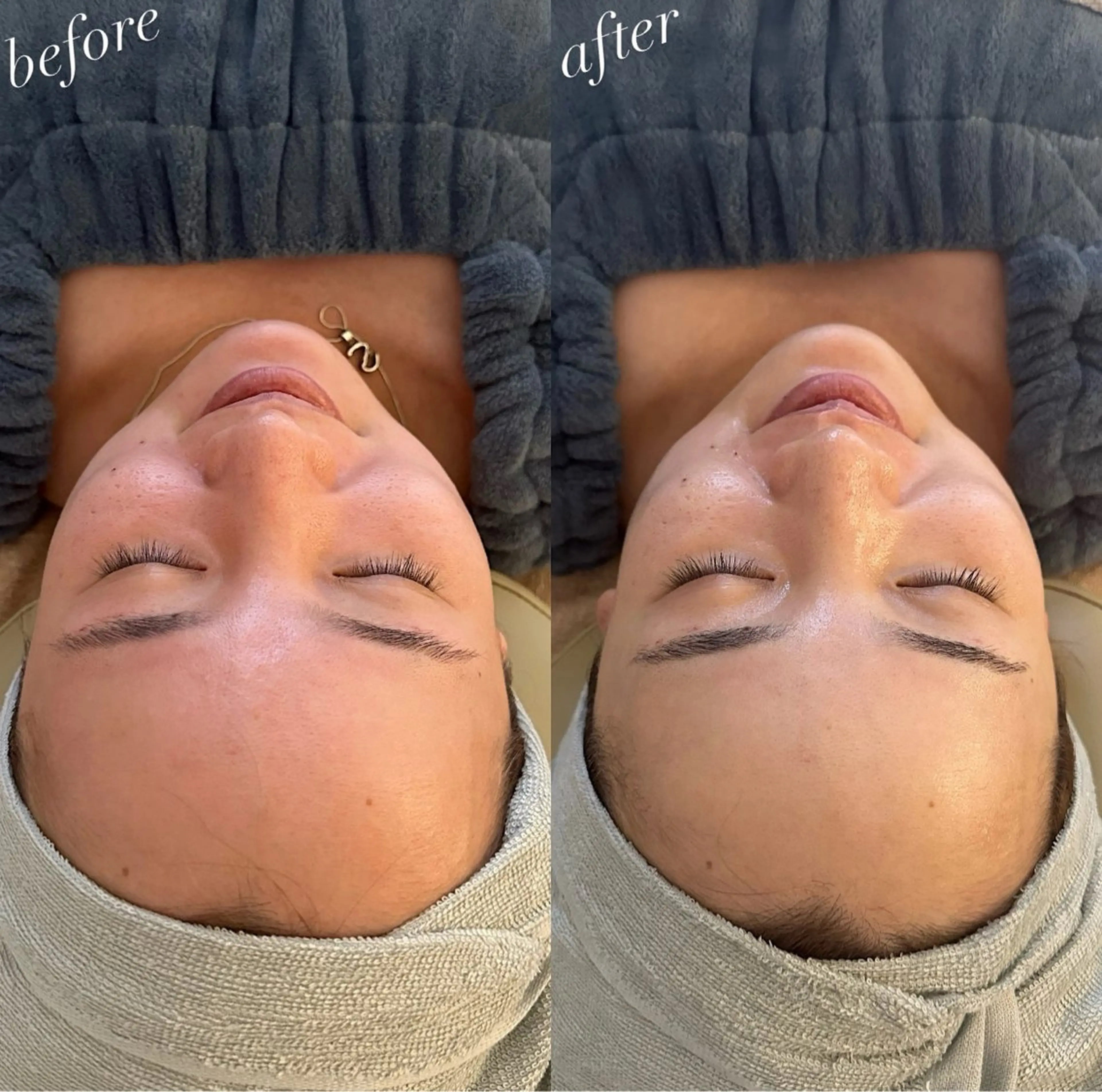 エステ うなじ脱毛/美肌脱毛 LABELのエステ・リラクイメージ