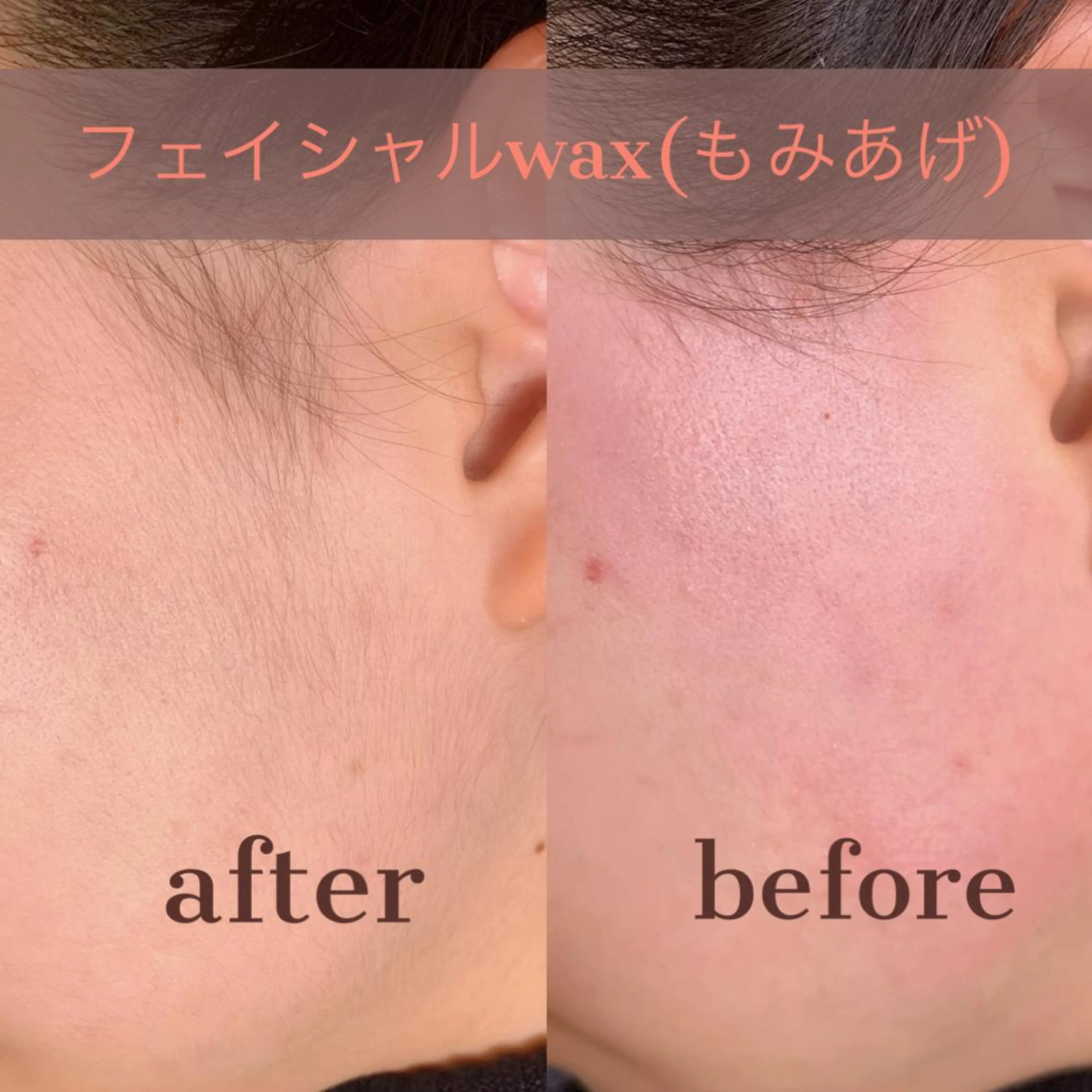 フェイシャルWax(もみあげ)の写真