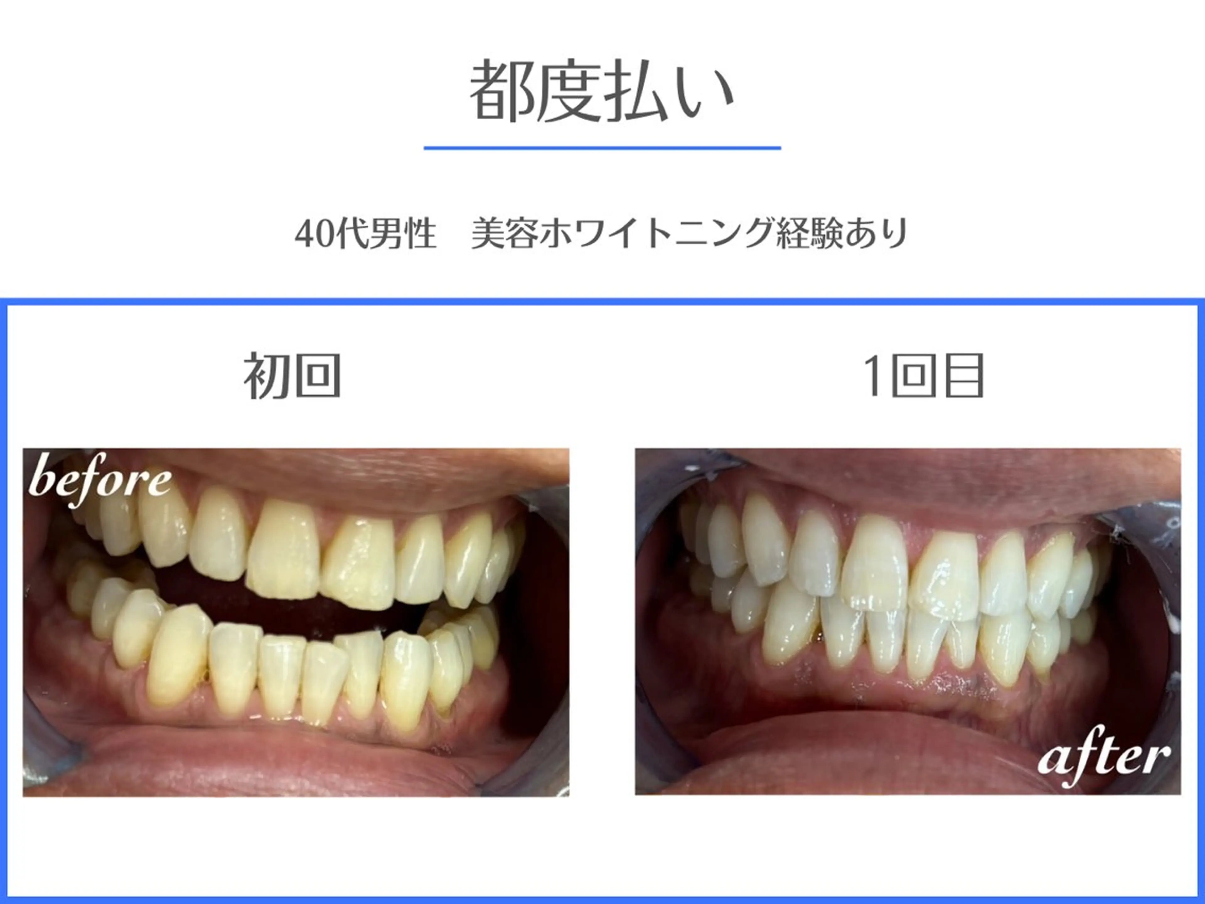 その他 ホワイトニング/脱毛 専門店エクシア岡崎店のその他イメージ