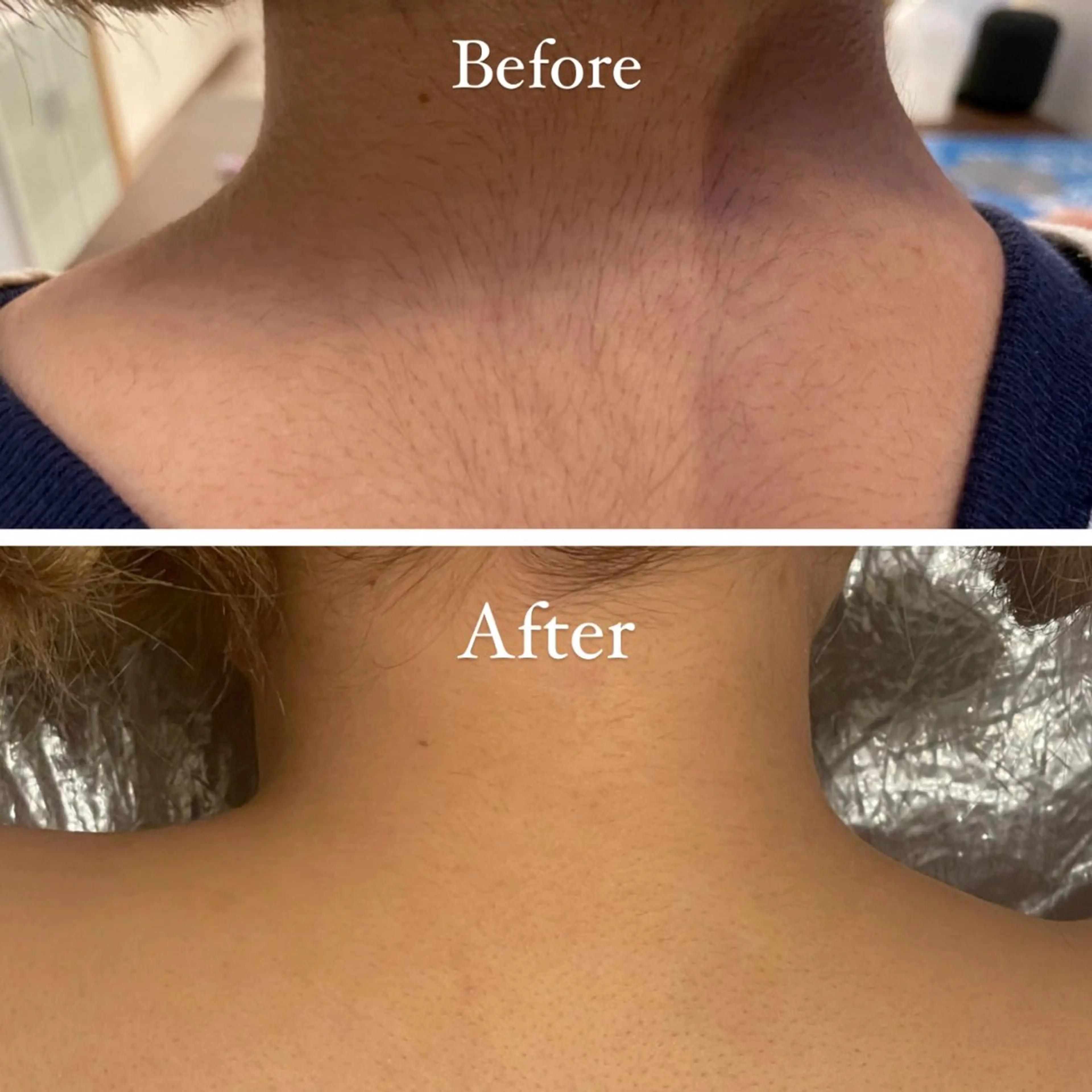 脱毛 Tulipe Chihoのエステ・リラクイメージ