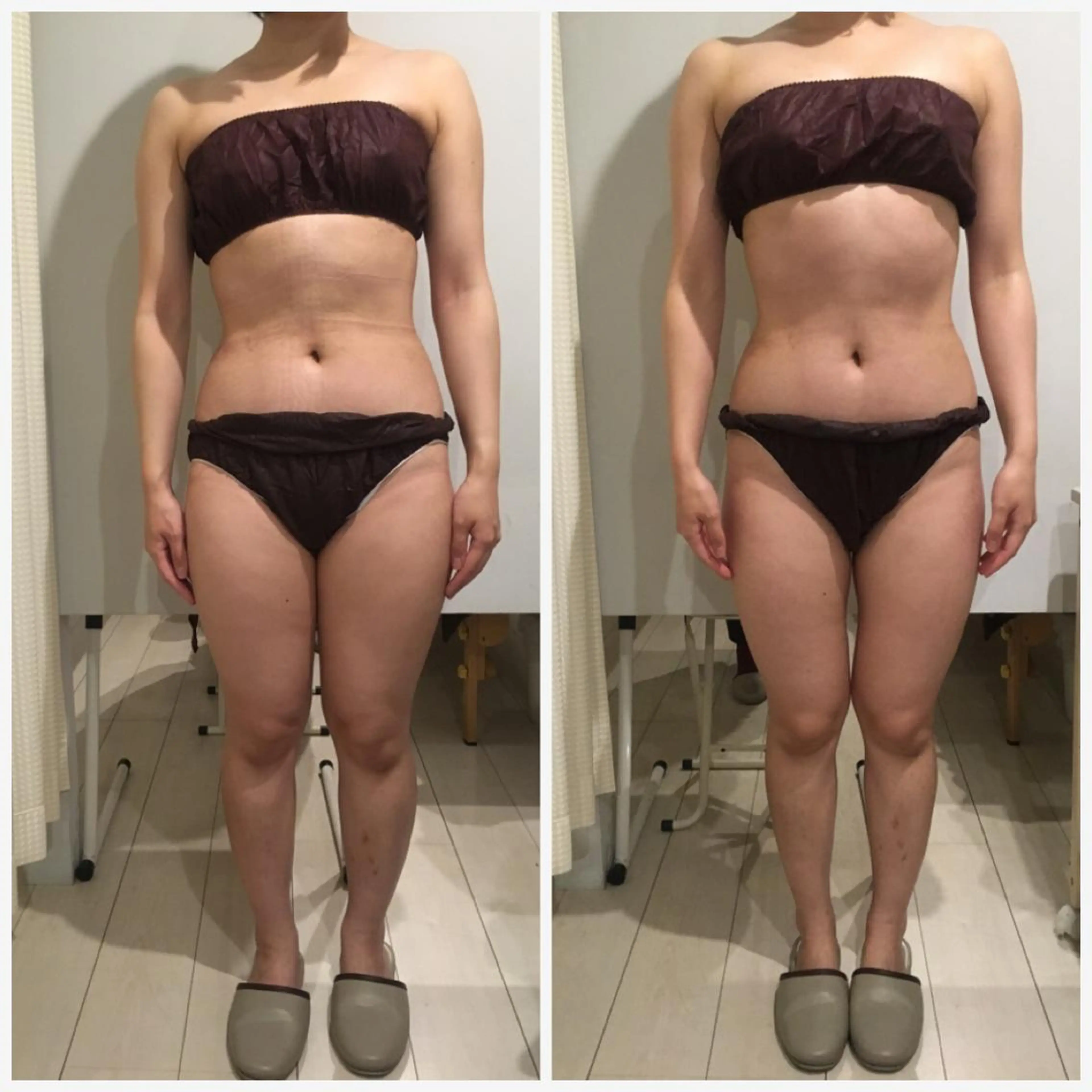 アニメ,Vオタク× 即効痩せエステサロンのエステ・リラクイメージ