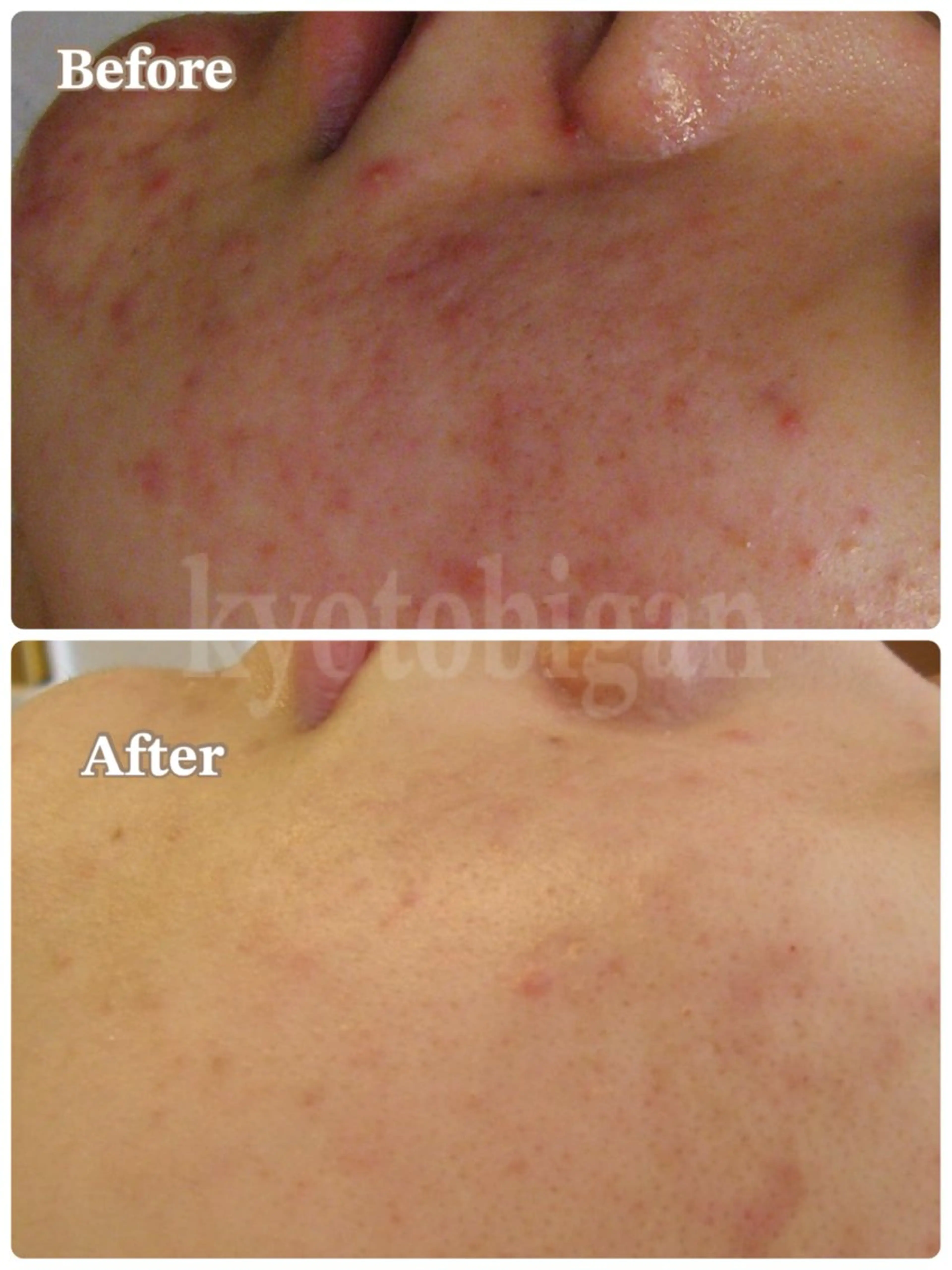 エステ さかた さと美のエステ・リラクイメージ