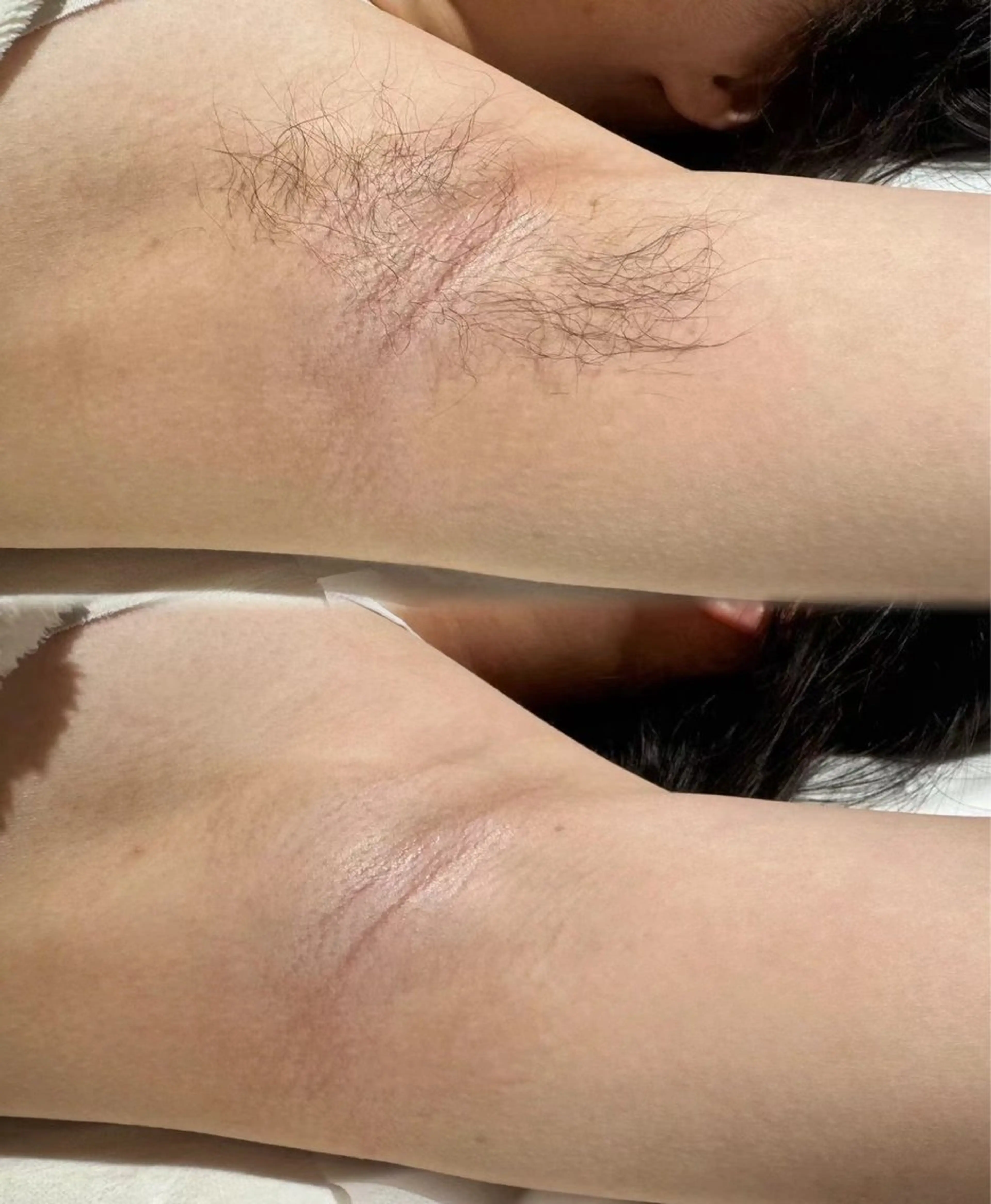 マツエク・マツパ エステ aliaハーブ水光店 エステティシャン募集のエステ・リラクイメージ