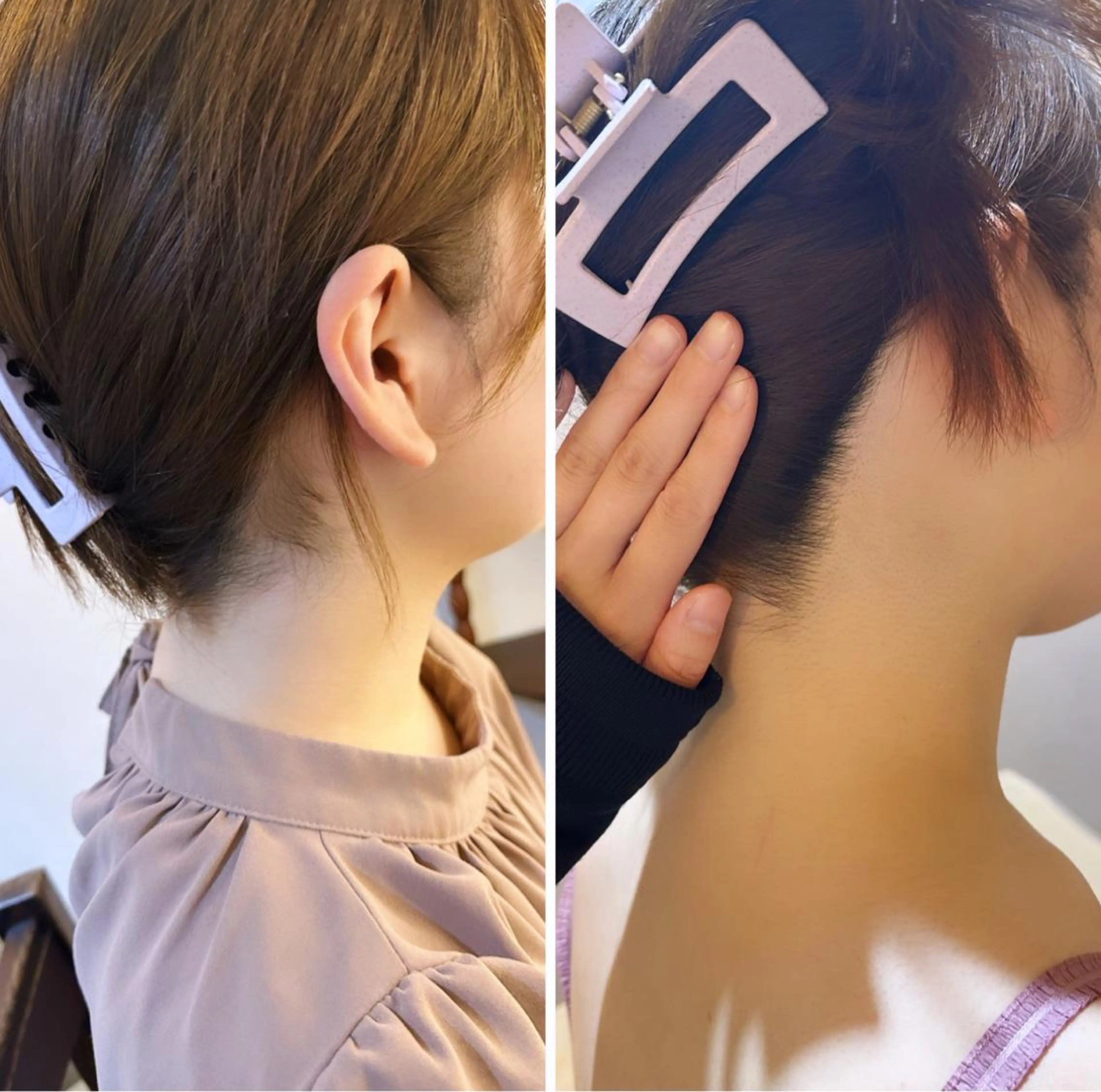 うなじ脱毛/美肌脱毛 LABELのエステ・リラクイメージ