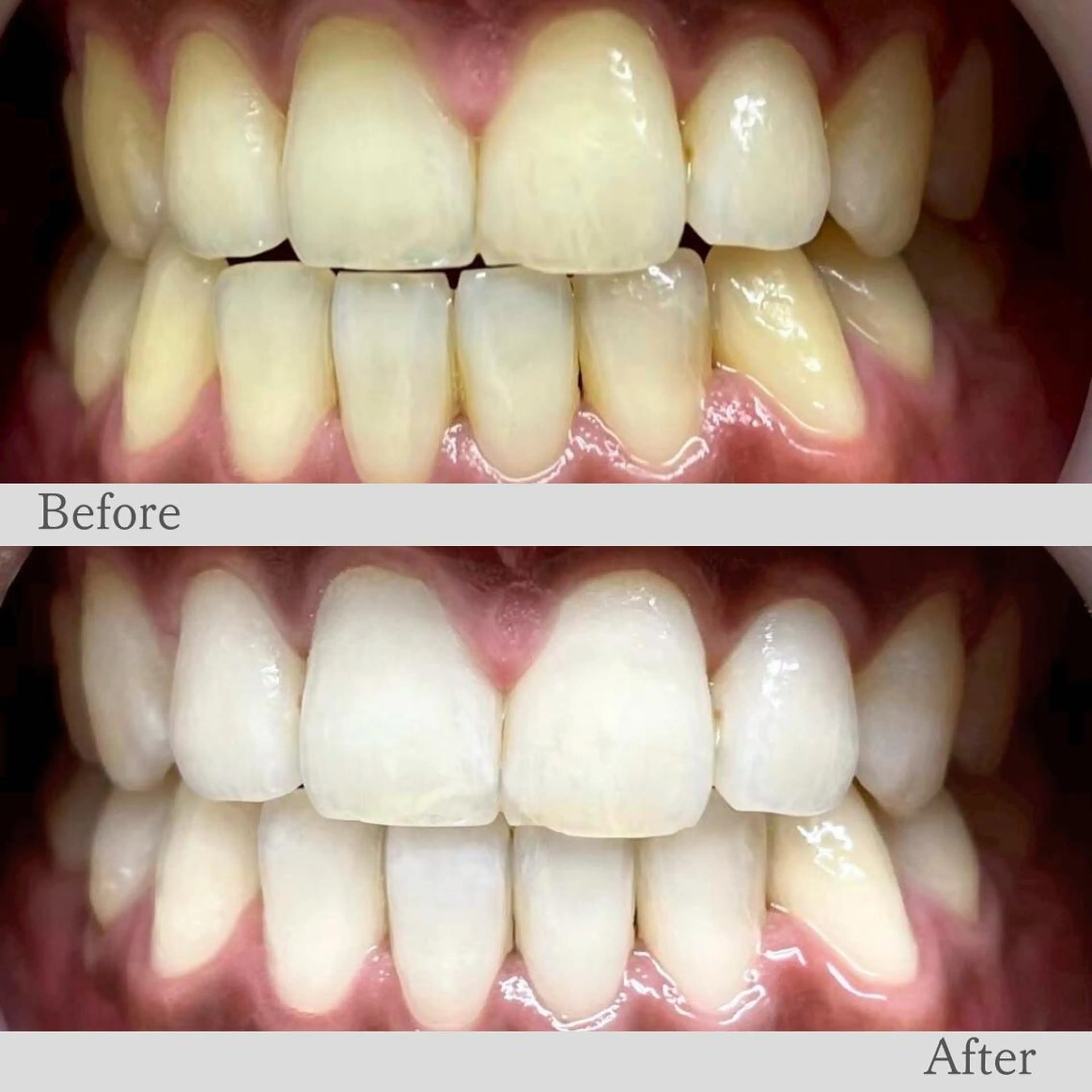 LBS吉祥寺 公式のエステ・リラクイメージ