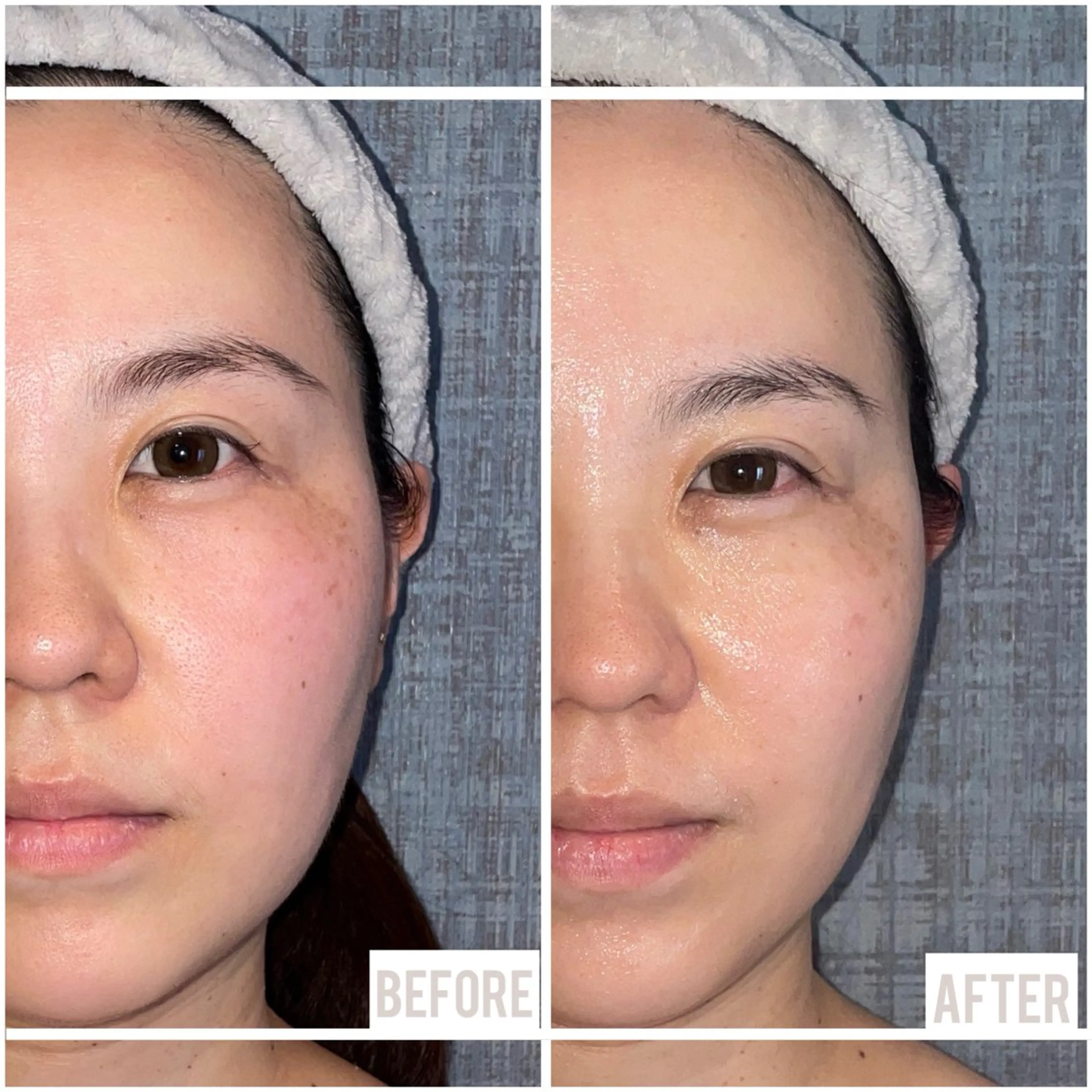 《初回限定》🧏‍♀️余分な脂肪ぽいっ✨理想のお顔を叶えるこりとりコルギ+【ぽにょ取りマシン】✨ 130分の写真