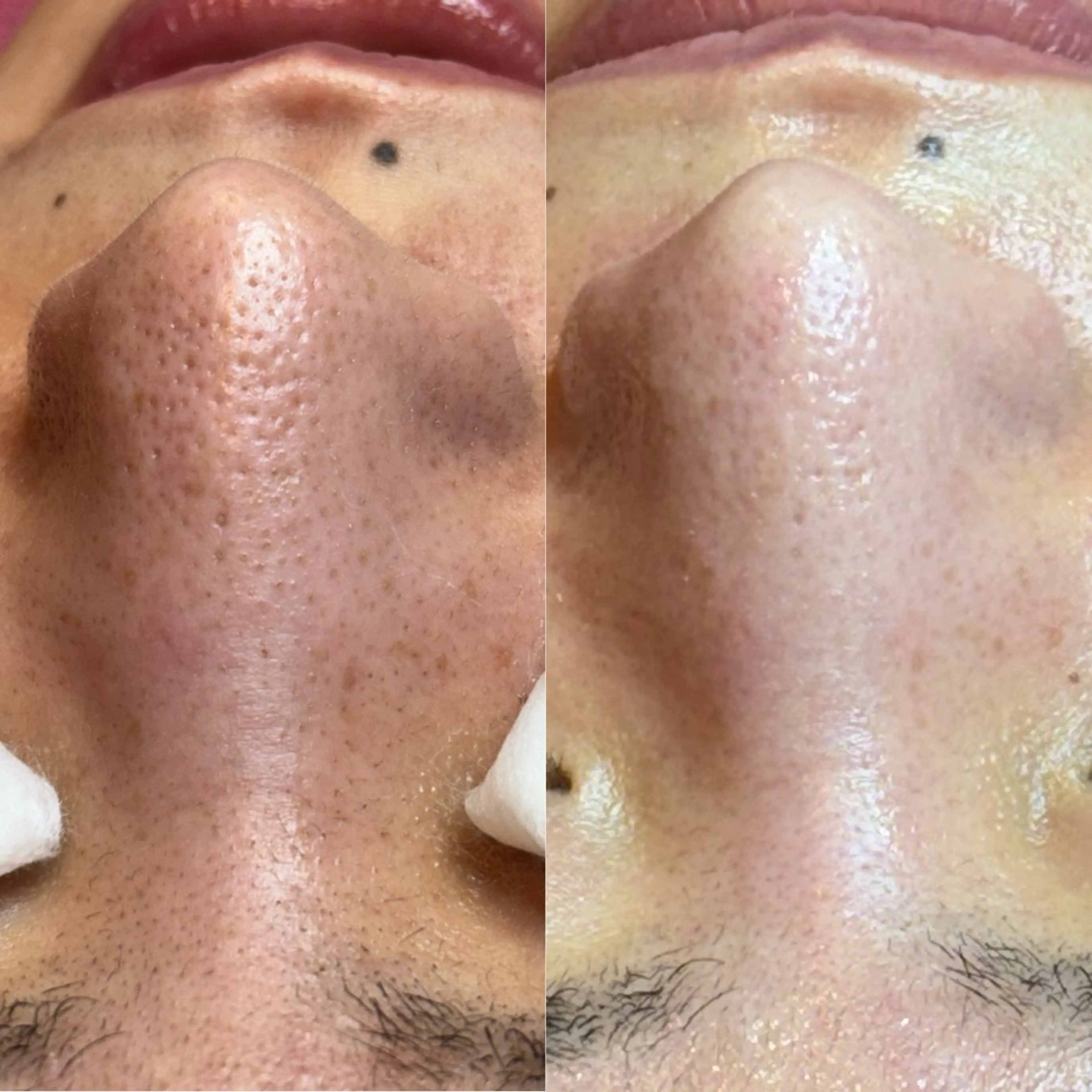 エステ 【美肌専門店】 Salon de Aのエステ・リラクイメージ