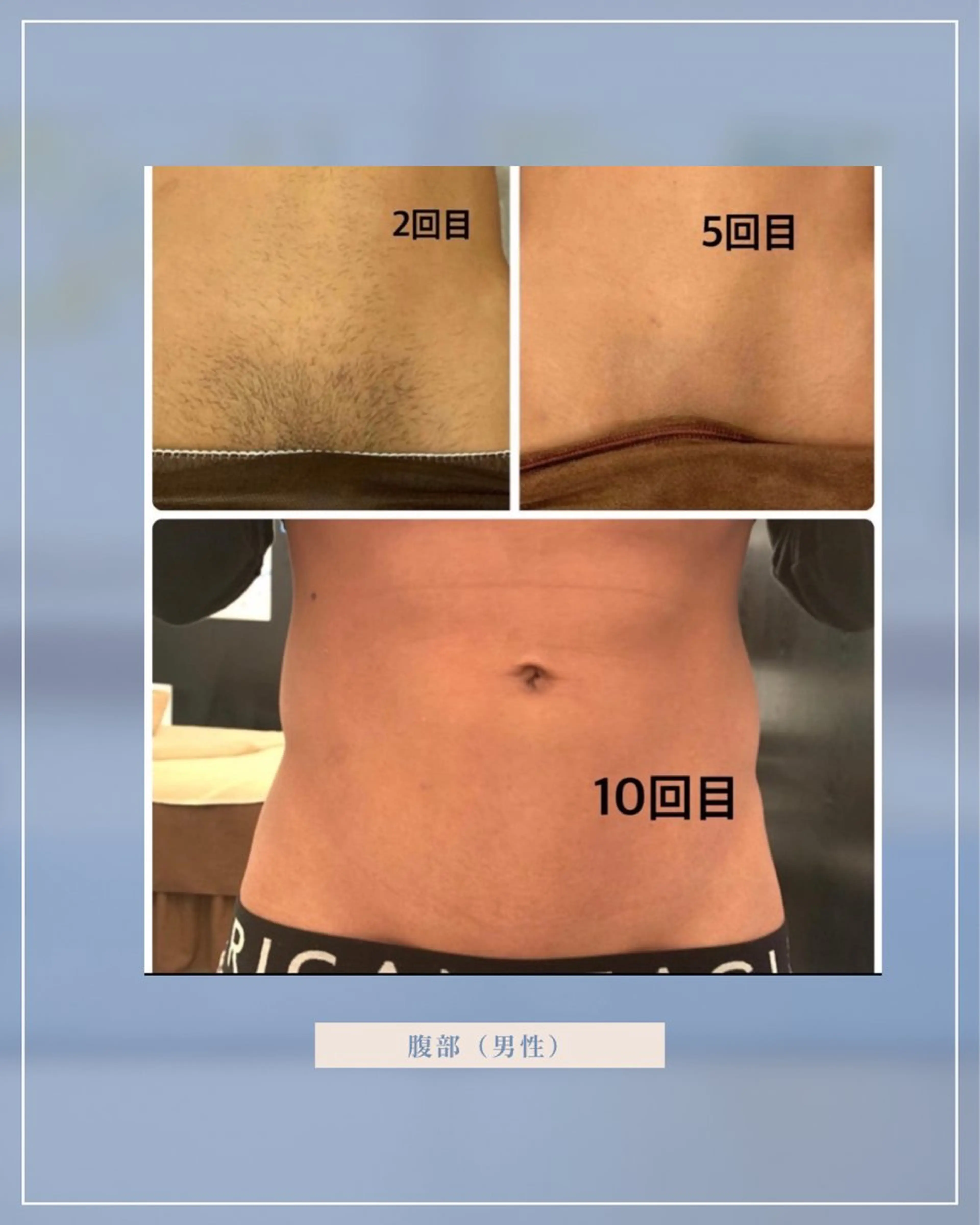 脱毛サロンChavi 東府中店のエステ・リラクイメージ