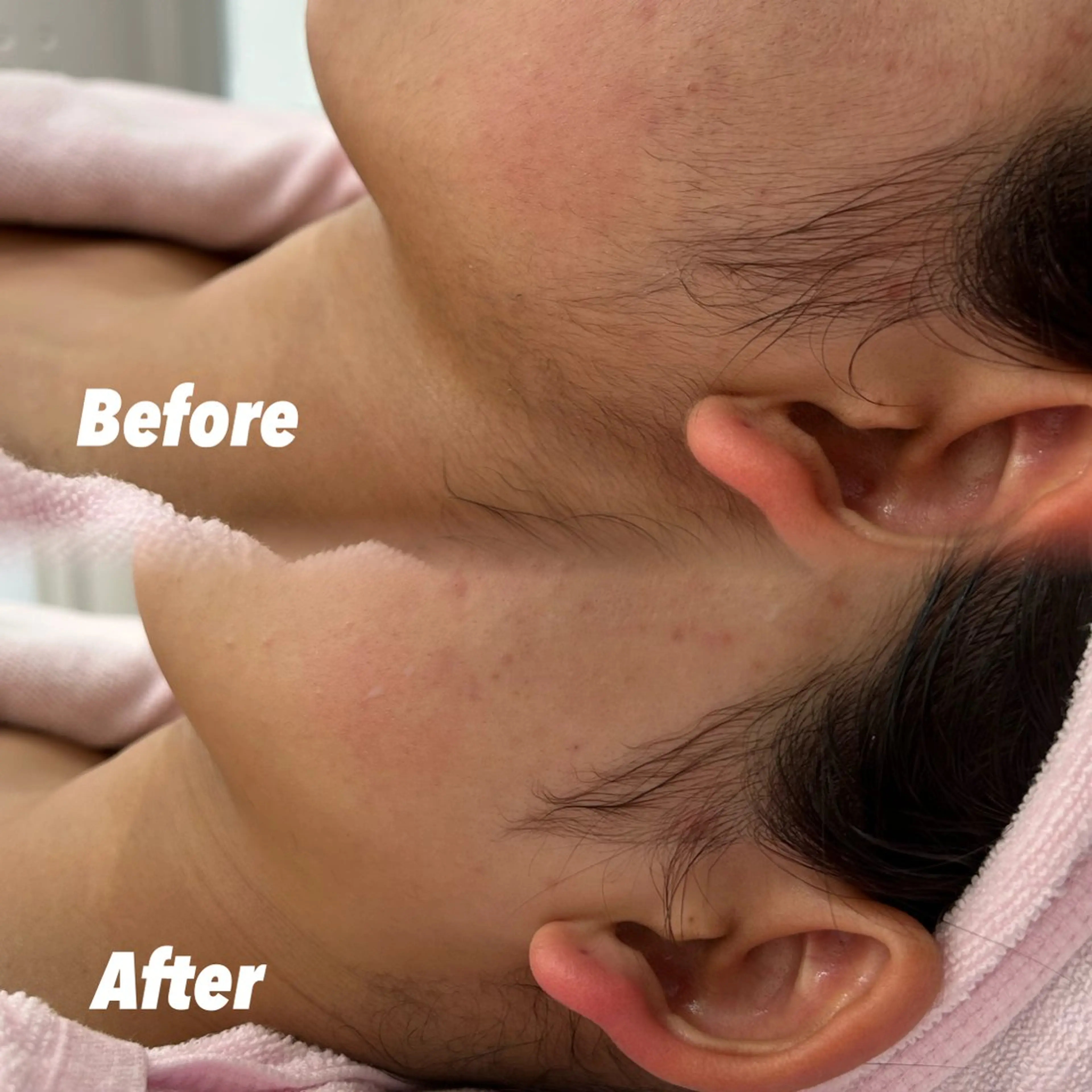 その他 🫧美しい素肌へ🫧 今成柚乃のその他イメージ